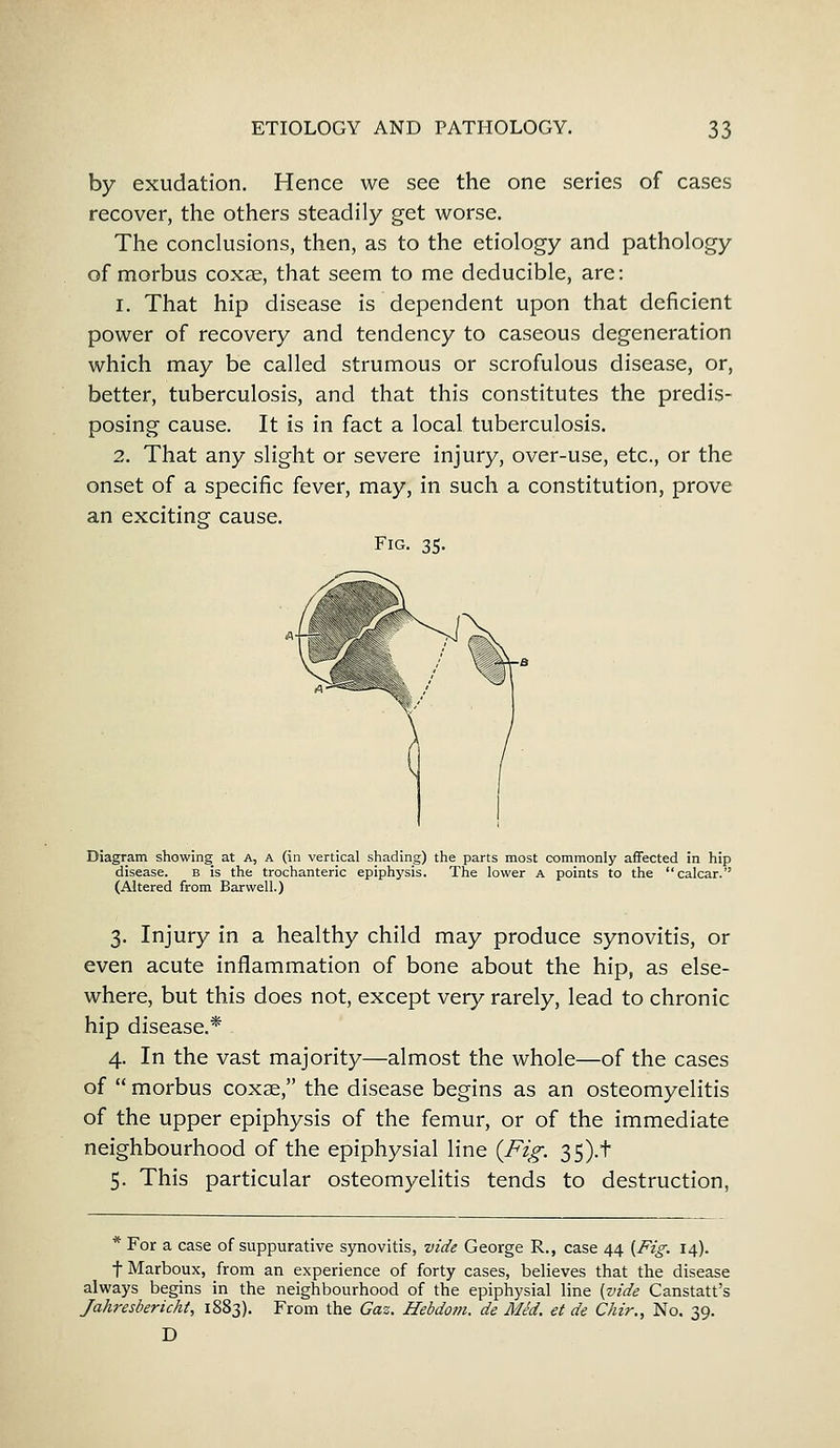 by exudation. Hence we see the one series of cases recover, the others steadily get worse. The conclusions, then, as to the etiology and pathology of morbus coxae, that seem to me deducible, are: 1. That hip disease is dependent upon that deficient power of recovery and tendency to caseous degeneration which may be called strumous or scrofulous disease, or, better, tuberculosis, and that this constitutes the predis- posing cause. It is in fact a local tuberculosis. 2. That any slight or severe injury, over-use, etc., or the onset of a specific fever, may, in such a constitution, prove an exciting cause. Fig. 35. Diagram showing at a, a (in vertical shading) the parts most commonly affected in hip disease. B is the trochanteric epiphysis. The lower A points to the calcar. (Altered from Bar well.) 3. Injury in a healthy child may produce synovitis, or even acute inflammation of bone about the hip, as else- where, but this does not, except very rarely, lead to chronic hip disease.* 4. In the vast majority—almost the whole—of the cases of  morbus coxae, the disease begins as an osteomyelitis of the upper epiphysis of the femur, or of the immediate neighbourhood of the epiphysial line {Fig. 35).t 5. This particular osteomyelitis tends to destruction, * For a case of suppurative synovitis, vide George R., case 44 [Fig. 14). f Marboux, from an experience of forty cases, believes that the disease always begins in the neighbourhood of the epiphysial line [vide Canstatt's Jahresbericht, 1883). From the Gaz. Hebdo?n. de Med. et de Ckir., No. 39. D