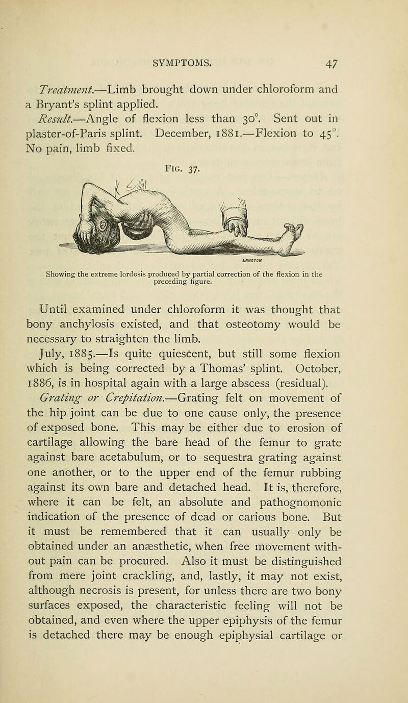 Treatment.—Limb brought down under chloroform and a Bryant's splint applied. Result.—Angle of flexion less than 300. Sent out in plaster-of-Paris splint. December, 1881.—Flexion to 450. No pain, limb fixed. Fig. 37. Showing the extreme lordosis produced by partial correction of the flexion in the preceding figure. Until examined under chloroform it was thought that bony anchylosis existed, and that osteotomy would be necessary to straighten the limb. July, 1885.—Is quite quiescent, but still some flexion which is being corrected by a Thomas' splint. October, 1886, is in hospital again with a large abscess (residual). Grating or Crepitation.—Grating felt on movement of the hip joint can be due to one cause only, the presence of exposed bone. This may be either due to erosion of cartilage allowing the bare head of the femur to grate against bare acetabulum, or to sequestra grating against one another, or to the upper end of the femur rubbing against its own bare and detached head. It is, therefore, where it can be felt, an absolute and pathognomonic indication of the presence of dead or carious bone. But it must be remembered that it can usually only be obtained under an anaesthetic, when free movement with- out pain can be procured. Also it must be distinguished from mere joint crackling, and, lastly, it may not exist, although necrosis is present, for unless there are two bony surfaces exposed, the characteristic feeling will not be obtained, and even where the upper epiphysis of the femur is detached there may be enough epiphysial cartilage or