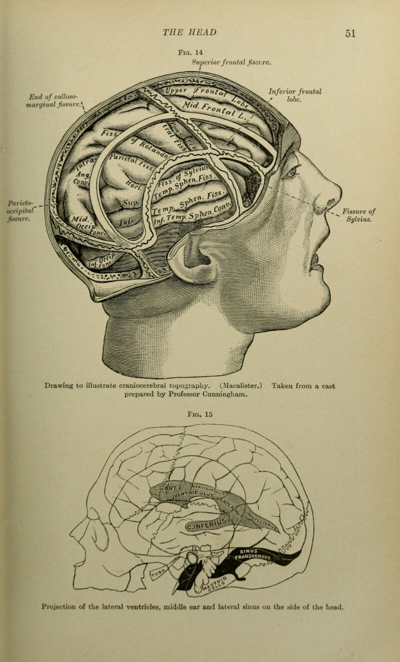 Fig. 14 Superior frontal fissure. End of calloso marginal fissure.\ Inferior frontal lobe. tcdpital Mature. Fissure of Sylvius. Drawing to illustrate craniocerebral topography. (Macalister.) Taken from a cast prepared by Professor Cunningham. Fig. 15 tion '>( the lateral ventricles, middle car and lateral Minus on the .--i'lc; <>f the head.