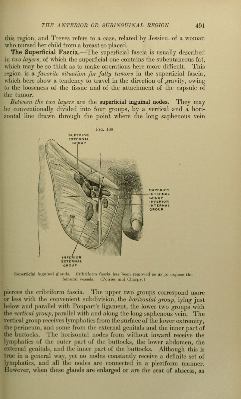 this region, and Treves refers to a case, related by Jessieu, of a woman who nursed her child from a breast so placed. The Superficial Fascia.—The superficial fascia is usually described in two layers, of which the superficial one contains the subcutaneous fat, which may be so thick as to make operations here more difficult. This region is a favorite situation for fatty tumors in the superficial fascia, which here show a tendency to travel in the direction of gravity, owing to the looseness of the tissue and of the attachment of the capsule of the tumor. Between the two layers are the superficial inguinal nodes. They may be conventionally divided into four groups, by a vertical and a hori- zontal line drawn through the point where the long saphenous vein Fig. 168 SUPERIOR EXTERNAL lOUP SUPERIOR INTERNAL GROUP INFERIOR INTERNAL GROUP INFERIOR EXTERNAL GROUP r icial inguinal glands. Cribriform fascia has been removed so as ,to expose the femoral vessels. (Poirier and Charpy.) pierces the cribriform fascia. The upper two groups correspond more n less with the convenient subdivision, the horizontal group, lying just below and parallel with Poupart's ligament, the lower two groups with the vertical group,parallel with and along the Long saphenous vein. The jrertical group receives lymphatics from the surface of the lower extremity, the perineum, and some from the external genitals and the inner pari of die buttocks. The horizontal nodes from without inward receive the lymphatics of the outer part of the buttocks, the lower abdomen, the e\t. in;,! genitals, and the inner pari of the buttocks. Although this is true in a general way, yet do node-, constantly receive a definite set of lymphatics, and all the node.-, are connected in a plexiform manner. How< ' i, when these glands arc enlarged or are the seat of abscess, as