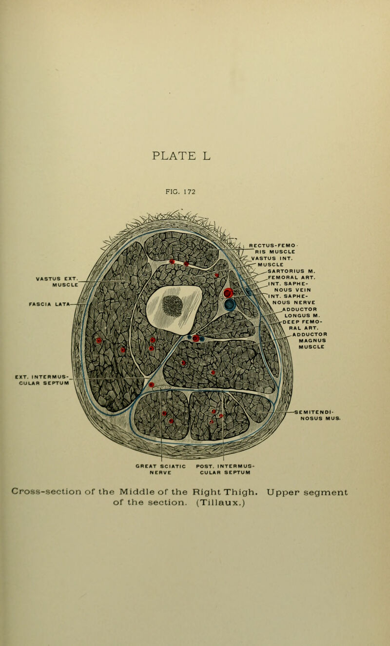 PLATE L FIG. 172 VASTUS EXT MUSCLE FASCIA LATA—* EXT. INTERMUS- CULAR SEPT l) RECTUS-FEMO- RIS MUSCLE K|£Z VASTUS INT. '/^Jr) \jj> '^r muscle «n&\ • V':\V~>^'SARTOR'US M' ^^W\\>ife^'^^FEMORAL ART. iPHE- I VEIN iPHE- NERVE DUCTOR INGUS M. EP FEMO- »AL ART. ADDUCTOR MAGNUS MUSCLE SEMITENDI- NOSUS MUS. GREAT SCIATIC POST. INTERMUS- NERVE CULAR SEPTUM Cross-section of the Middle or the Right Thigh. Upper segment of the section. (Tillaux.)