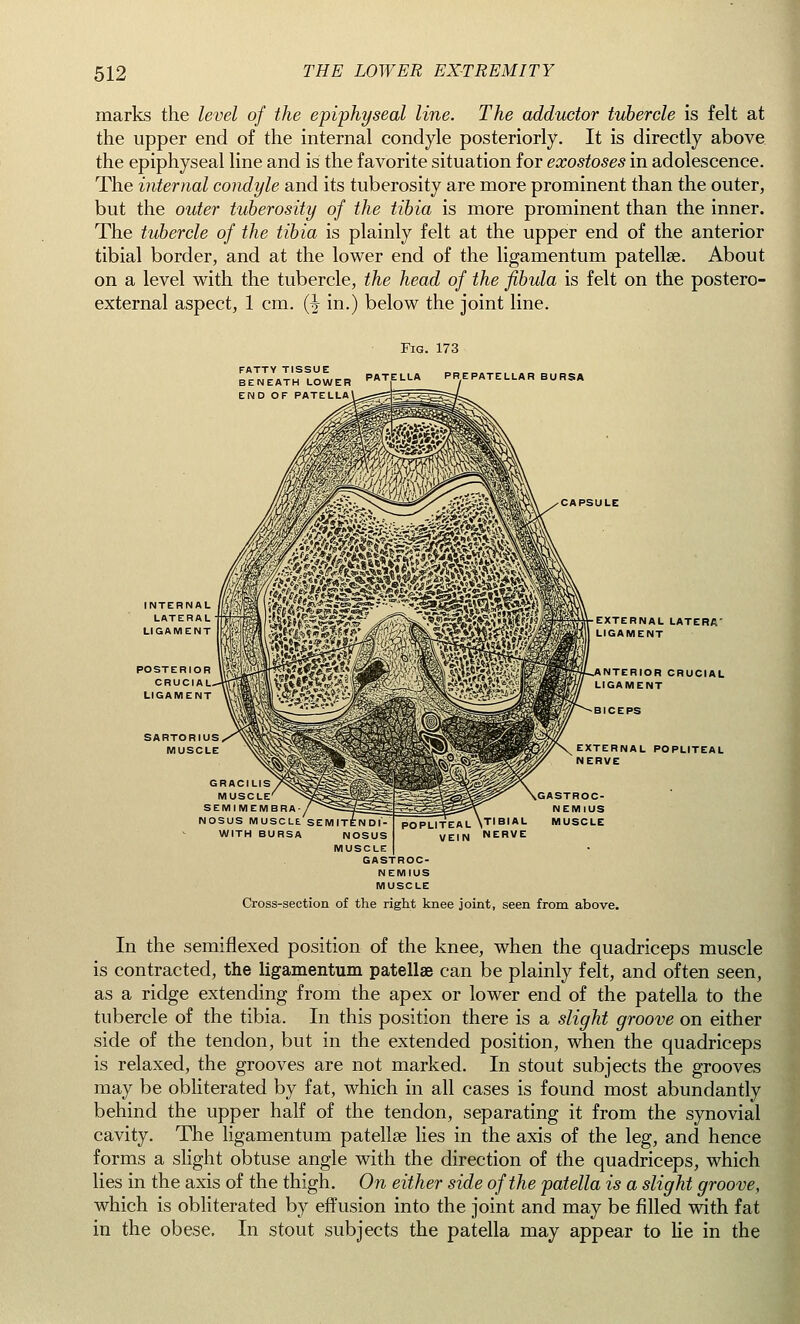 marks the level of the epiphyseal line. The adductor tubercle is felt at the upper end of the internal condyle posteriorly. It is directly above the epiphyseal line and is the favorite situation for exostoses in adolescence. The internal condyle and its tuberosity are more prominent than the outer, but the outer tuberosity of the tibia is more prominent than the inner. The tubercle of the tibia is plainly felt at the upper end of the anterior tibial border, and at the lower end of the ligamentum patellae. About on a level with the tubercle, the head of the fibula is felt on the postero- external aspect, 1 cm. (-| in.) below the joint line. FATTY TISSUE BENEATH LOWER END OF PATEL Fig. 173 patella prepatellar bursa INTERNAL LATERAL LIGAMENT POSTERIOR CRUCIAL LIGAMENT SARTORIUS MUSCLE EXTERNAL LATERA' LIGAMENT NTERIOR CRUCIAL LIGAMENT EXTERNAL POPLITEAL NERVE GRACILIS MUSCLE SEMIMEMBRA NOSUS muscle'semitendi' WITH BURSA NOSUS MUSCLE GASTROC- NEMIUS TIBIAL MUSCLE VE!N NERVE GASTROC- NEMIUS MUSCLE Cross-section of the right knee joint, seen from above. In the semiflexed position of the knee, when the quadriceps muscle is contracted, the ligamentum patellae can be plainly felt, and often seen, as a ridge extending from the apex or lower end of the patella to the tubercle of the tibia. In this position there is a slight groove on either side of the tendon, but in the extended position, when the quadriceps is relaxed, the grooves are not marked. In stout subjects the grooves may be obliterated by fat, which in all cases is found most abundantly behind the upper half of the tendon, separating it from the synovial cavity. The ligamentum patellae lies in the axis of the leg, and hence forms a slight obtuse angle with the direction of the quadriceps, which lies in the axis of the thigh. On either side of the patella is a slight groove, which is obliterated by effusion into the joint and may be filled with fat in the obese. In stout subjects the patella may appear to He in the