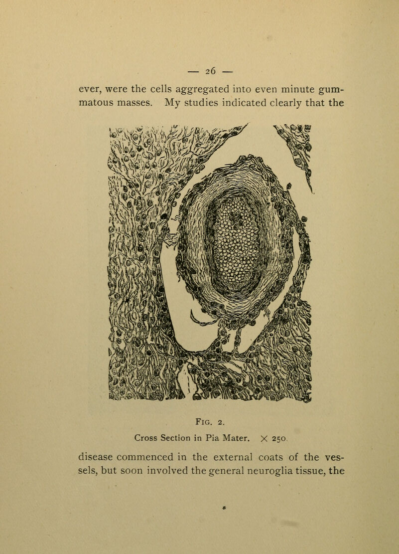 ever, were the cells aggregated into even minute gum- matous masses. My studies indicated clearly that the Fig. 2. Cross Section in Pia Mater. X 250 disease commenced in the external coats of the ves- sels, but soon involved the general neuroglia tissue, the