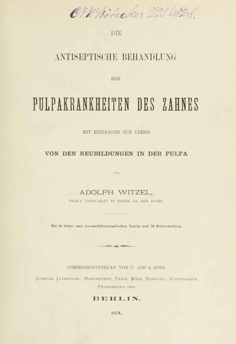 e^^J^A^e^-i mf^^^. DIE ANTISErilSCHE BEHANDLUNG DER PÜLPAKRAlfOEITEN DES UiNES MIT BEITRAGEN ZUR LEHRE VON DEN NEUBILDUNGEN IN DER PULPA ADOLPH WITZEL, l'RACT. ZAHN-ARZT IN ESSEN AN DER Kl'HR. )lit l^ lilJin- und >'liniiiiolitliosnii)liisclii<ii Tofrln und ;u llul/scliiiillrii. COMMISSIONSVERI.Ar, VON C. ASIT k SONS. j_ondon, j-iverpool-, /manchester, paris, )vlen, f4amburg, kopenhagen, Petersburg und 13 E Ft I. T IV.