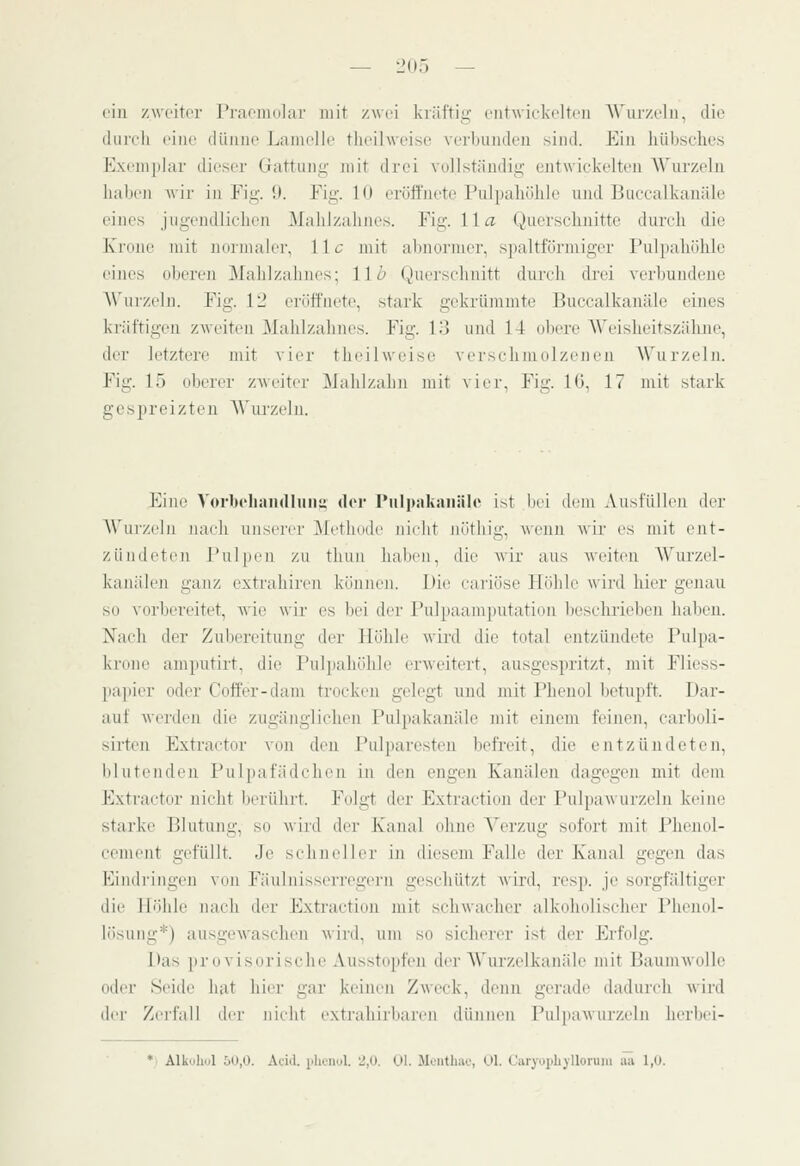 ein zwciti'i' Pi'afiiKilar mit zwei kväl'tiü' ciitwirkcltrn Wuiv.clii, die (liircli i'iuc clüuuo Lauicllc tlirilwrisc verbunden sind. Ein hübselies E.\eni])]ar dieser Gattung- jnit drei vollständig entwickelten AVurzeln hallen wii- in Fig. 9. Fig. 10 eröffnete Pulpaliölile und Ijueealkanäle eines jugendlichen Mahlzahnes. Fig. IIa Querschnitte durch die Krone mit normaler, l\c mit abnormer, spaltförmiger Pulpahöhle eines oberen Malilzahnes; IIb Querschnitt durch drei verbundene A\'urzelji. Fig. 12 eröffnete, stark gekrümmte Buccalkanälc eines kräftigen zweiten Malilzahnes. Fig. DJ und 14 obere AVeisheitszälme, der letztere mit vier theilweise verschmolzenen Wurzeln. Fig. 15 oberer zweiter Mahlzahu mit vier, Fig. lü, 17 mit stark gespreizten AVurzeln. Eiiu' A'orboliaiKlluiii; der PulpaKanäle ist \n'\ dem .\ustiillen der AVurzeln nach unserer Alethode iiii-lit niithig, wenn wii' es mit ent- zündeten l'ulpen zu thun haben, dit' wir aus weiten W'urzel- kanäleii ganz extraliiren können. Die cariöse Höhle wird hier genau so vorbereitet, Avie wir es bei der Pulpaamputation besclirieben haben. Nach der Zubereitung der Höhle wird die total entzündete Pulpa- krone amputirt, die Pulpaliölile erweitert, ausgespritzt, mit Fliess- papier oder Coffer-daiu trocken gelegt und mit Phenol betupft. Dar- auf werden die zugänglichen Pulpakanäle mit einem feinen, carboli- sirten Extractor von den l'ulparesten befreit, die entzündeten, blutenden Pulpafädclieii in den engen Kanälen dagegen mit dem Extractor nicht berührt. Fidgt der Extraction der Pulpawurztdn keine starke Blutung, so wiid dei' Kanal ohne Verzug sofort mit Phenol- cement gefüllt. Je schni'ller in diesem Falle der Kanal gegen das Eindringen von Fäulnissei-ri'geni gesidiiitzt wird, resji. je sorgfältiger die Höhle nach der Extraction mit schwacher alkoholischer Phenol- lösuiig*) ausgewaschen wird, um so sicln-rer ist der Erfolg. Das pr II visorisclie .Vusstopfen der AVurzelkanäle mit Baumwolle oder Seiile hat hier gar keinen Zweck, denn gerade dadui-ch Avird der Zei-fall der nicht extrahirliareii dünnen Pulpawurzeln lierbei- *i Alkohol 50,0. Aciii. plicnol. '.^,0. Ol. Moiithao, Ol. CaryopLjUorum aa 1,0.