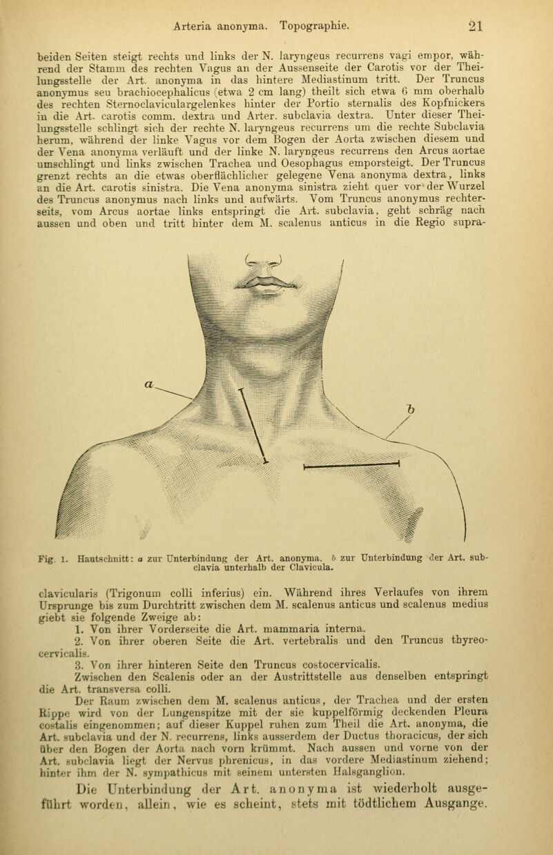 beiden Seiten steigt rechts und links der N. Jaryngeus recurrens vagi empor, wäh- rend der Stamm des rechten Vagus an der Aussenseite der Carotis vor der Thei- lungsstelle der Art. anonyma in das hintere Mediastinum tritt. Der Truncus anonjTnus seu brachiocephalicus (etwa 2 cm lang) theilt sich etwa 6 mm oberhalb des rechten Sternoclaviculargelenkes hinter der Portio sternalis des Kopfnickera in die Art. carotis comm. dextra und Arter. subclavia dextra. Unter dieser Thei- lungsstelle schlingt sich der rechte N. laryngeus recurrens um die rechte Subclavia herum, während der linke Vagus vor dem Bogen der Aorta zwischen diesem und der Vena anonyma verläuft und der linke N. laryngeus recurrens den Arcus aortae umschlingt und links zwischen Trachea und Oesophagus emporsteigt. Der Truncus grenzt rechts an die etwas oberflächlicher gelegene Vena anonyma dextra, links an die Art. carotis sinistra. Die Vena anonyma sinistra zieht quer vor der Wurzel des Truncus anonymus nach links und aufwärts. Vom Truncus anonymus rechter- seits, vom Arcus aortae links entspringt die Art. subclavia, geht schräg nach aussen und oben und tritt hinter dem M. scalenus anticus in die Regio supra- Fig. 1. Hautschnitt: a zur Unterbindung der Art. anonyma. b zur Unterbindung der Art. sub- clavia unterhalb der Clavicula. clavicularis (Trigonum colli inferius) ein. Während ihres Verlaufes von ihrem Ursprünge bis zum Durchtritt zwischen dem M. scalenus anticus und scalenus medius giebt sie folgende Zweige ab: 1. Von ihrer Vorderseite die Art. mammaria interna. 2. Von ihrer oberen Seite die Art. vertebralis und den Truncus thyreo- cervicalis. 3. Von ihrer hinteren Seite den Truncus costocervicalis. Zwischen den Scalenis oder an der Austrittstelle aus denselben entspringt die Art. transversa colli. Der Raum zwischen dem M. scalenus anticus, der Trachea und der ersten Rippe wird von der Lungenspitze mit der sie kuppeiförmig deckenden Pleura coHtalis eingenommen; auf dieser Kuppel ruhen zum Theil die Art. anonyma, die Art. subclavia und der N. recurrens, links ausserdem der Ductus thoracicus, der sich über den Bogen der Aorta nach vorn krümmt. Nach aussen und vorne von der Art. subclavia liegt der Nervus phrenicus, in das vordere Mediastinum ziehend; hinter ihm der N. sympathicus mit seinem untersten Halsganglion. Die Unterbindung der Art. anonyma ist wiederholt ausge- führt worden, allein, wie es scheint, stets mit tödtlichem Ausgange.