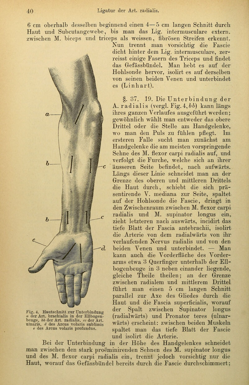 6 cm oberhalb desselben beginnend einen 4—5 cm langen Scbnitt durch Haut und Subcutangewebe, bis man das Lig. intermusculare extern. zwischen M. biceps und triceps als weissen, fibrösen Streifen erkennt. Nun trennt man vorsichtig die Fascie dicht hinter dem Lig. intermusculare, zer- reisst einige Fasern des Triceps und findet das Gefässbündel. Man hebt es auf der Hohlsonde hervor, isolirt es auf derselben von seinen beiden Venen und unterbindet es (Linhart). §. 37. 19. Die Unterbindung der A. radialis (vergl. YigA^bb) kann längs ihres ganzen Verlaufes ausgeführt werden; gewöhnlich wählt man entweder das obere Drittel oder die Stelle am Handgelenke,^ wo man den Puls zu fühlen pflegt. Im ersteren Falle sucht man zunächst am Handgelenke die am meisten vorspringende Sehne des M. flexor carpi radialis auf, und verfolgt die Furche, welche sich an ihrer äusseren Seite befindet, nach aufwärts. Längs dieser Linie schneidet man an der Grenze des oberen und mittleren Drittels die Haut durch, schiebt die sich prä- sentirende V. mediana zur Seite, spaltet auf der Hohlsonde die Fascie, dringt in den Zwischenraum zwischen M. flexor carpi radialis und M. supinator longus ein,, zieht letzteren nach auswärts, incidirt das tiefe Blatt der Fascia antebrachii, isolirt die Arterie von dem radialwärts von ihr verlaufenden Nervus radialis und von den beiden Venen und unterbindet. — Man kann auch die Vorderfläche des Vorder- arms etwa 3 Querfinger unterhalb der Ell- bogenbeuge in 3 neben einander liegende, gleiche Theile theilen; an der Grenze zwischen radialem und mittlerem Drittel führt man einen 5 cm langen Schnitt parallel zur Axe des Gliedes durch die Haut und die Fascia superficialis, worauf der Spalt zwischen Supinator longus (radialwärts) und Pronator teres (ulnar- wärts) erscheint: zwischen beiden Muskeln spaltet man das tiefe Blatt der Fascie und isolirt die Arterie. Bei der Unterbindung in der Höhe des Handgelenkes schneidet man zwischen den stark proeminirenden Sehnen des M. supinator longus und des M. flexor carpi radialis ein, trennt jedoch vorsichtig nur die Haut, worauf das Gefässbündel bereits durch die Fascie durchschimmert; Fig. 4. Hautscliiiitt zur Unterbindung a der Art. brachialis in der Ellbogen- beuge, 66 der Art. radialis, ccder Art. ulnaris, d des Arcus volaris sublimis e des Arcus volaris profundus.