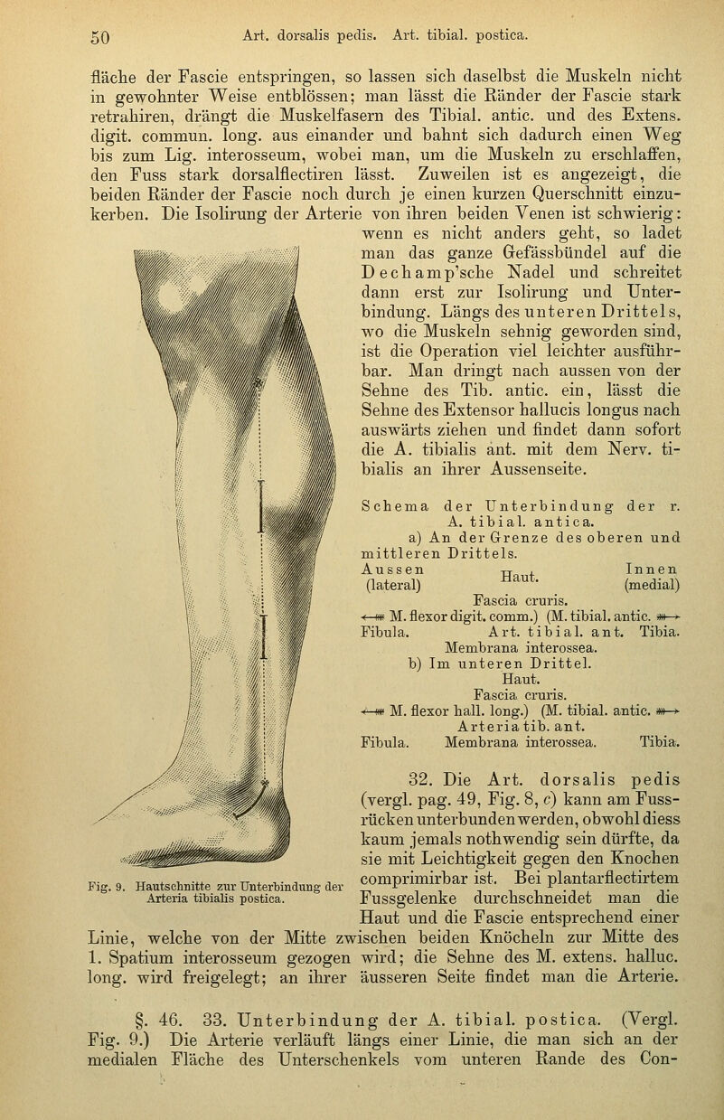 5ö Art. dorsalis pedis. Art. tibial. postica. fläche der Fascie entspringen, so lassen sich daselbst die Muskeln nicht in gewohnter Weise entblössen; man lässt die Ränder der Fascie stark retrahiren, drängt die Muskelfasern des Tibial. antic. und des Extens. digit. commun. long, aus einander und bahnt sich dadurch einen Weg bis zum Lig. interosseum, wobei man, um die Muskeln zu erschlaffen, den Fuss stark dorsalflectiren lässt. Zuweilen ist es angezeigt, die beiden Ränder der Fascie noch durch je einen kurzen Querschnitt einzu- kerben. Die Isolirung der Arterie von ihren beiden Venen ist schwierig: wenn es nicht anders geht, so ladet man das ganze Gefässbündel auf die Dechamp'sche Nadel und schreitet dann erst zur Isolirung und Unter- bindung. Längs des unteren Drittels, wo die Muskeln sehnig geworden sind, ist die Operation viel leichter ausführ- bar. Man dringt nach aussen von der Sehne des Tib. antic. ein, lässt die Sehne des Extensor hallucis longus nach auswärts ziehen und findet dann sofort die A. tibialis änt. mit dem Nerv, ti- bialis an ihrer Aussenseite. Schema der Unterbindung der r. A. tibial. antica. a) An der Grenze des oberen und mittleren Drittels. Aussen Hat Innen (lateral) ' (medial) Fascia cruris. ■(—m M. flexor digit. comm.) (M. tibial. antic. m~->- Fibula. Art. tibial. ant. Tibia. Membrana interossea. b) Im unteren Drittel. Haut. Fascia cruris. -<M« M. flexor hall, long.) (M. tibial. antic. »»—»■ Arteria tib. ant. Fibula. Membrana interossea. Tibia. 32. Die Art. dorsalis pedis (vergl. pag. 49, Fig. 8, c) kann am Fuss- rücken unterbunden werden, obwohl diess kaum jemals nothwendig sein dürfte, da sie mit Leichtigkeit gegen den Knochen comprimirbar ist. Bei plantarflectirtem Fussgelenke durchschneidet man die Haut und die Fascie entsprechend einer Linie, welche von der Mitte zwischen beiden Knöcheln zur Mitte des 1. Spatium interosseum gezogen wird; die Sehne des M. extens. halluc. long, wird freigelegt; an ihrer äusseren Seite findet man die Arterie. Fi 9. Hautschnitte zur Unterbindung der Arteria tibialis postica. §. 46. 33. Unterbindung der A. tibial. postica. (Vergl. Fig. 9.) Die Arterie verläuft längs einer Linie, die man sich an der medialen Fläche des Unterschenkels vom unteren Rande des Con-