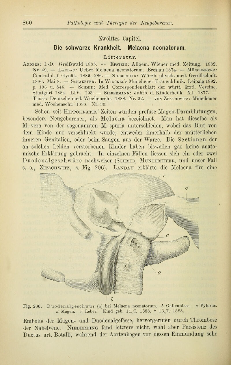 Zwölftes Capitel. Die schwarze Krankheit. Melaena neonatorum. liitteratur. Anders: I.-D. Greifswald 1885. — Epstein: Allgem. Wiener med. Zeitung. 1882. Nr. 49. — Landau: lieber Melaena neonatorum. Breslau 1874. — Münchmeyer: Centralbl. f. G-jnäk. 1889. 286. — Nieberding: Würzb. physik.-med. G-esellscliaft. 1886. Mais. — Schaeffer: In Winckel's Müuchener Frauenklinik. Leipzig 1892. p. 196 u. 546. •— Schmid: Med. Correspondeuzblatt der württ. ärztl. Vereine. Stuttgart 1884. LIV. 193. — Silbermann: Jahrb. d. Kinderbeilk. XL 1877. — Tross: Deutsche med. Woebenschr. 1888. Nr. 22. — von Zezschwitz: Münchener med. Wochenschr. 1888. Nr. 30. Schon seit Hippokeates' Zeiten wurden profuse Magen-Darmblutungen, besonders Neugeborener, als Melaena bezeichnet. Man hat dieselbe als M. Vera von der sogenannten M. spuria unterschieden, wobei das Blut von dem Kinde nur verschluckt wurde, entweder innerhalb der mütterlichen inneren G-enitalien, oder beim Saugen aus der Warze. Die Sectionen der an solchen Leiden verstorbenen Kinder haben bisweilen gar keine anato- mische Erklärung gebracht. In einzelnen Fällen Hessen sich ein oder zwei Duodenalgeschwüre nachweisen (Schmid, MtJisrcHMETEE, und unser Fall s. 0., Zezschwitz, s. Fig. 206). Landau erklärte die Melaena für eine M '^ b. Fig. 206. Duodenalgeschwür (a) bei Melaena ueonatorum. h Gallenblase, c Pylorus. d Magen, e Leber. Kiud geb. ll./I. 1888, f 13./I. 1888. Embolie der Magen- und Duodenalgefässe, hervorgerufen durch Thrombose der Nabelvene. Nibbeeding fand letztere nicht, wohl aber Persistenz des Ductus art. Botalli, während der Aortenbogen vor dessen Einmündung sehr