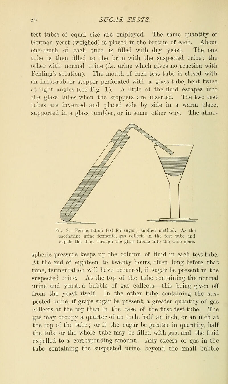 test tubes of equal size are employed. The same qtiantity of German yeast (weighed) is placed in the bottom of each. About one-tenth of each tube is filled with dry yeast. The one tube is then filled to the brim with the suspected urine; the other with normal urine (i.e. urine which gives no reaction with Fehling's solution). The mouth of each test tube is closed with an india-rubber stopper perforated with a glass tube, bent twice at right angles (see Fig. 1). A little of the fluid escapes into the glass tubes when the stoppers are inserted. The two test tubes are inverted and placed side by side in a warm place, supported in a glass tumbler, or in some other way. The atmo- Fig. 2.—Fermentation test for sugar; another method. As the saccharine urine ferments, gas collects in the test tube and exjiels the fluid through the glass tubing into the wine glass. spheric pressure keeps up the column of fluid in each test tube. At the end of eighteen to twenty hours, often long before that time, fermentation will have occurred, if sugar be present in the suspected urine. At the top of the tube containing the normal urine and yeast, a bubble of gas collects—this being given off from the yeast itself. In the other tube containing the sus- pected urine, if grape sugar be present, a greater quantity of gas collects at the top than in the case of the first test tube. The gas may occupy a quarter of an inch, half an inch, or an inch at the top of the tube; or if the sugar be greater in quantity, half the tube or the whole tube may be filled with gas, and the fluid expelled to a corresponding amount. Any excess of gas in the tube containing the suspected urine, beyond the small bubble