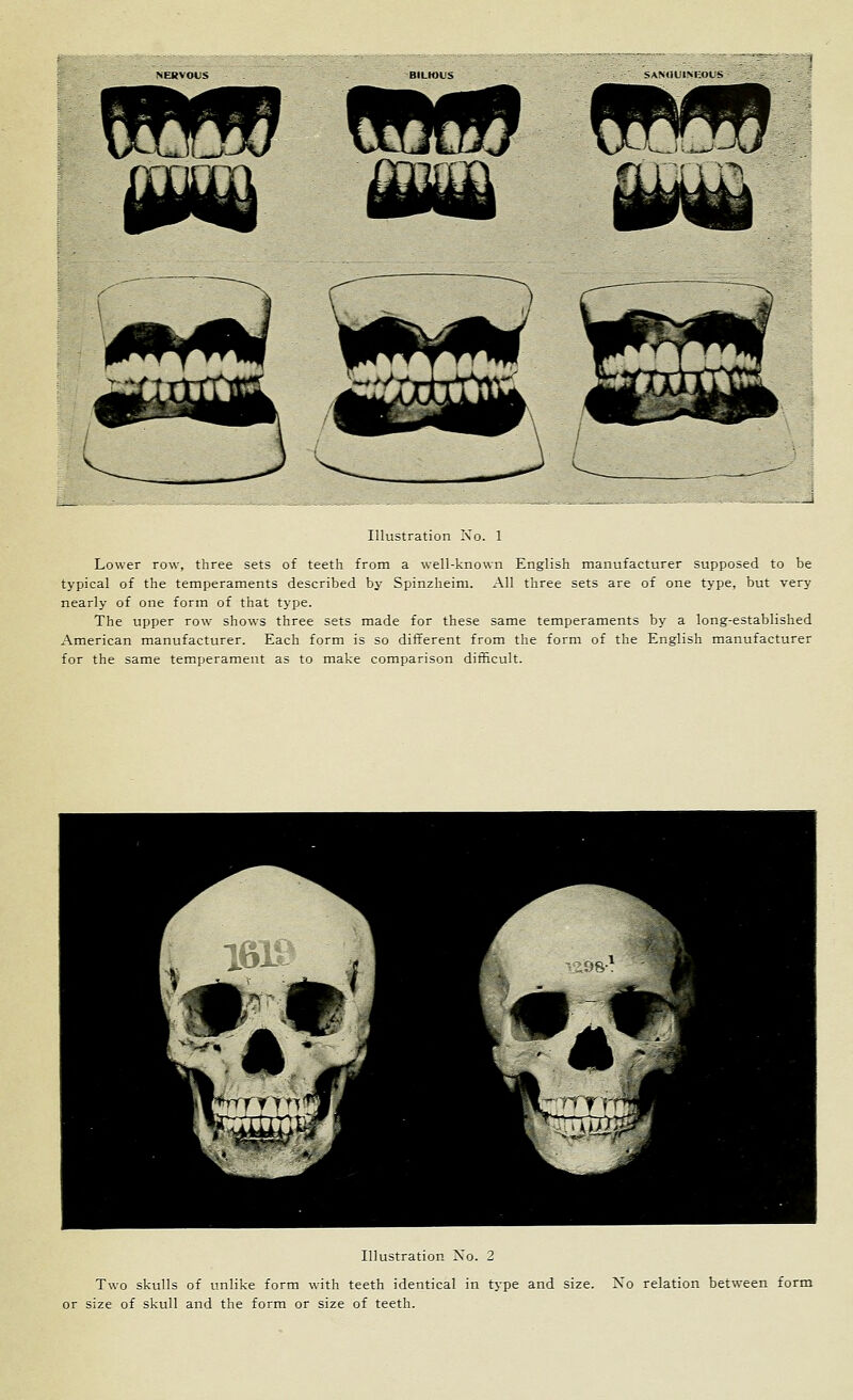 SANOUISI-IOUS CM? fBSflP f!RW Illustration No. 1 Lower row, three sets of teeth from a well-known English manufacturer supposed to be typical of the temperaments described by Spinzheim. All three sets are of one type, but very nearly of one form of that type. The upper row shows three sets made for these same temperaments by a long-established American manufacturer. Each form is so different from the form of the English manufacturer for the same temperament as to make comparison diificult. Illustration No. 2 Two skulls of unlike form with teeth identical in type and size. No relation between form or size of skull and the form or size of teeth.