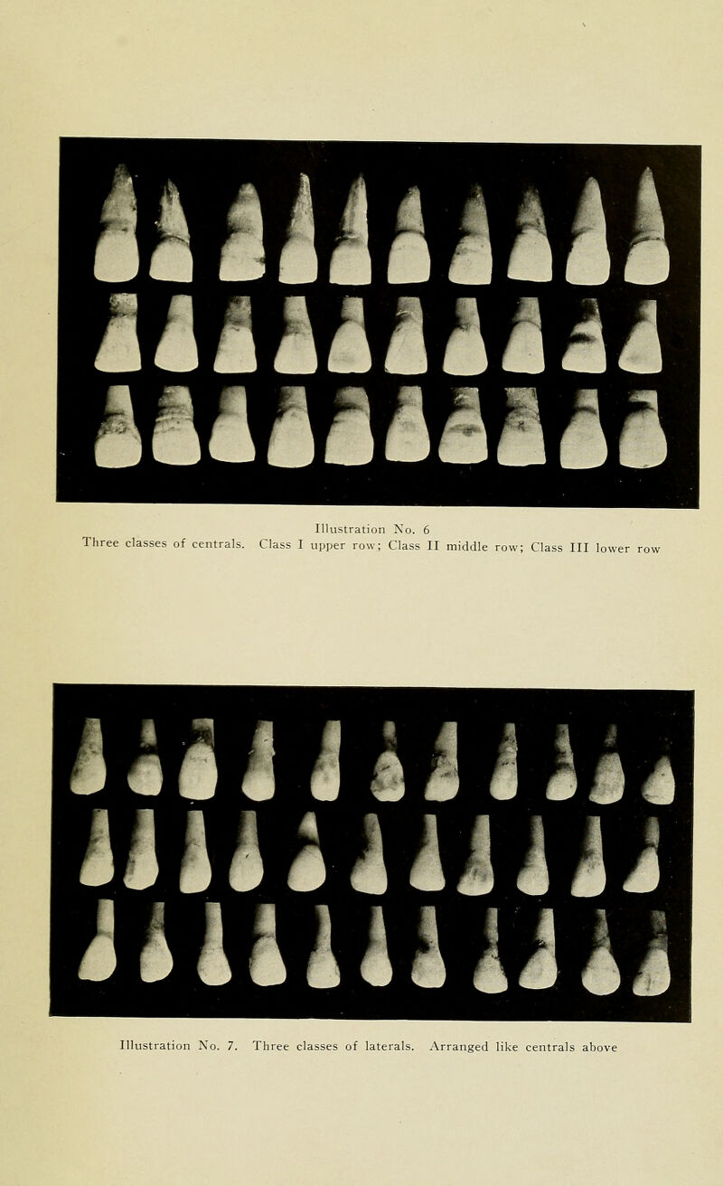 Illustration No. 6 Three classes of centrals. Class I upper row; Class II middle row; Class III lower row Illustration No. 7. Three classes of laterals. Arranged like centrals above