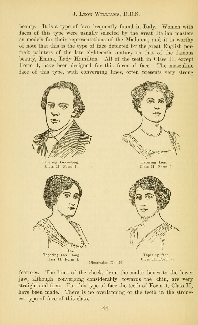 beauty. It is a type of face frequently found in Italy. Women with faces of this type were usually selected by the great Italian masters as models for their representations of the Madonna, and it is worthy of note that this is the type of face depicted by the great English por- trait painters of the late eighteenth century as that of the famous beauty, Emma, Lady Hamilton, All of the teeth in Class II, except Form 1, have been designed for this form of face. The masculine face of this type, with converging lines, often presents very strong Tapering face—long. Class II, Form 1. Tapering face. Class II, Form Tapering face—long. Class II, Form 3. Illustration No. 29 Tapering face. Class II, Form 4. features. The lines of the cheek, from the malar bones to the lower jaw, although couA'-erging considerably towards the chin, are very straight and firm. For this type of face the teeth of Form 1, Class II, have been made. There is no overlapping of the teeth in the strong- est type of face of this class.