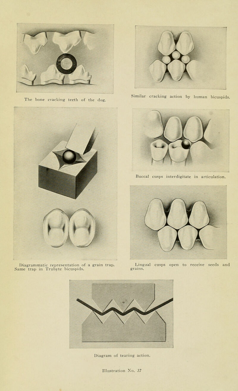 o The bone cracking teeth of the dog. Similar cracking action by human bicuspids. > r» ^ Buccal cusps interdigitate in articulation. Diagrammatic representation of a grain trap. Same trap in Trubyte bicuspids. Lingual cusps open to receive seeds and grains. Diagram of tearing action.
