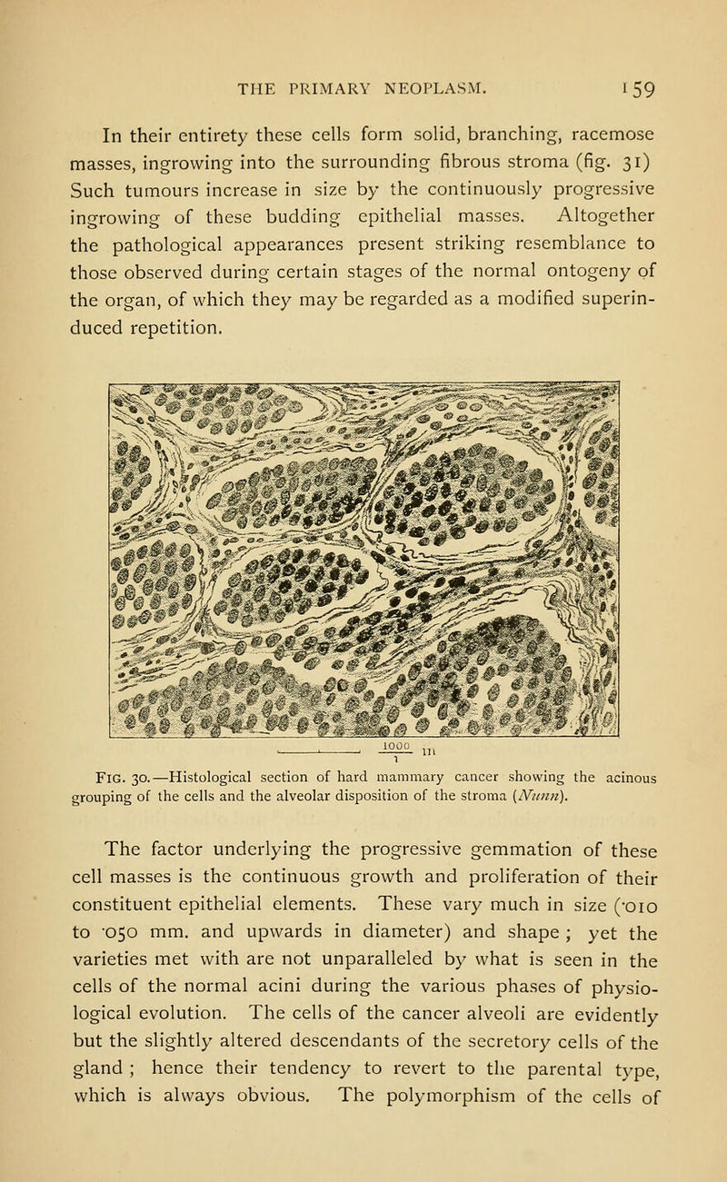 In their entirety these cells form solid, branching, racemose masses, ingrowing into the surrounding fibrous stroma (fig. 31) Such tumours increase in size by the continuously progressive ingrowing of these budding epithelial masses. Altogether the pathological appearances present striking resemblance to those observed during certain stages of the normal ontogeny of the organ, of which they may be regarded as a modified superin- duced repetition. Fig. 30.—Histological section of hard mammary cancer showing the acinous grouping of the cells and the alveolar disposition of the stroma (JVienu). The factor underlying the progressive gemmation of these cell masses is the continuous growth and proliferation of their constituent epithelial elements. These vary much in size (Oio to 050 mm. and upwards in diameter) and shape ; yet the varieties met with are not unparalleled by what is seen in the cells of the normal acini during the various phases of physio- logical evolution. The cells of the cancer alveoli are evidently but the slightly altered descendants of the secretory cells of the gland ; hence their tendency to revert to the parental type, which is always obvious. The polymorphism of the cells of