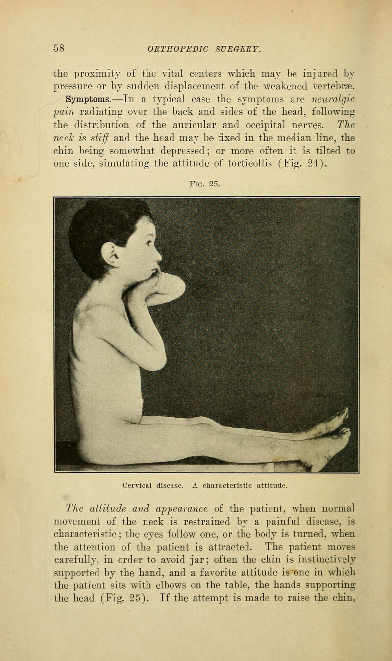 the proximity of the vital centers which may be injured by pressure or by sudden displacement of the weakened vertebrae. Symptoms.—In a typical case the symptoms are neuralgic pain radiating over the back and sides of the head, following the distribution of the auricular and occipital nerves. The neck is stiff and the head may be fixed in the median line, the chin being somewhat depressed; or more often it is tilted to one side, simulating the attitude of torticollis (Fig. 24). Fig. 25. Cervical disease. A characteristic attitude. The attitude and appearance of the patient, when normal movement of the neck is restrained by a painful disease, is characteristic; the eyes follow one, or the body is turned, when the attention of the patient is attracted. The patient moves carefully, in order to avoid jar; often the chin is instinctively supported by the hand, and a favorite attitude is'one in which the patient sits with elbows on the table, the hands supporting the head (Fig. 25). If the attempt is made to raise the chin,