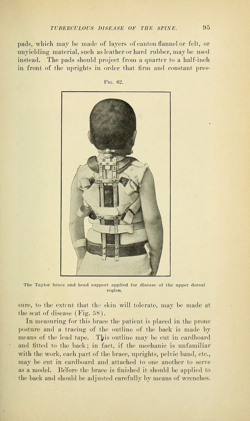 pads, which may be made of layers of canton flannel or felt, or unyielding material, such as leather or hard rubber, may be used instead. The pads should project from a quarter to a half-inch in front of the uprights in order that firm and constant pres- FiG. 62. The Taylor brace and head support applied for disease of the upper dorsal region. sure, to the extent that the skin will tolerate, may be made at the seat of disease (Fig. 58). In measuring for this brace the patient is placed in the prone posture and a tracing of the outline of the back is made by means of the lead tape. T]^is outline may be cut in cardboard and fitted to the back; in fact, if the mechanic is unfamiliar with the work, each part of the brace, uprights, pelvic band, etc., may be cut in cardboard and attached to one another to serve as a model. Be'fore the brace is finished it should be applied to the back and should be adjusted carefully by means of wrenches.