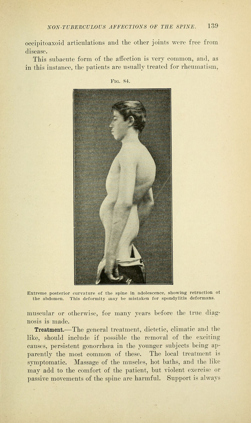 occipitoaxoid articulations and the other joints were free from disease. This subacute form of the affection is very common, and, as in this instance, the patients are usually treated for rheumatism, Fig. 84. Extreme posterior curvature of the spine in adolescence, sliowing retraction of the abdomen. This deformity may be mistalien for spondylitis deformans. muscular or otherwise, for many years before the true diag- nosis is made. Treatment.—The general treatment, dietetic, climatic and the like, should include if possible the removal of the exciting causes, persistent gonorrhoea in the younger subjects being ap- parently the most common of these. The local treatment is symptomatic. Massage of the muscles, hot baths, and the like may add to the comfort of the patient, but violent exercise or passive movements of the spine are harmful. Support is always