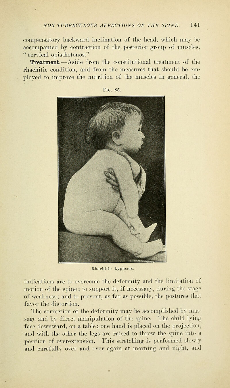 compensatory backward inclination of the head, which may be accompanied by contraction of the posterior group of muscles,  cervical opisthotonos. Treatment.^—Aside from the constitutional treatment of the rhachitic condition, and from the measures that should be em- ployed to improve the nutrition of the muscles in general, the Fig. 85. Rhachitic kyphosis. indications are to overcome the deformity and the limitation of motion of the spine; to support it, if necessary, during the stage of weakness; and to prevent, as far as possible, the postures that favor the distortion. The correction of the deformity may be accomplished by mas- sage and by direct manipulation of the spine. The child lying face downward, on a table; one hand is placed on the projection, and with the other the legs are raised to throw the spine into a position of overextension. This stretching is performed slowly and carefully over and over again at morning and night, and