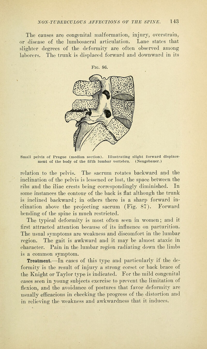 The causes are congenital malformation, injury, overstrain, or disease of the lumbosacral articulation. Lane states that slighter degrees of the deformity are often observed among laborers. The trunk is displaced forvs^ard and downward in its Fig. 86, Small pelvis of Prague (median section). IlUistrating slight forward displace- ment of the body of the fifth lumbar vertebra. (Neugebauer.) relation to the pelvis. The sacrum rotates backward and the inclination of the pelvis is lessened or lost, the space between the ribs and the iliac crests being correspondingly diminished. In some instances the contour of the back is flat although the trunk is inclined backward; in others there is a sharp forward in- clination above the projecting sacrum (Fig. 87). Forward bending of the spine is much restricted. The typical deformity is most often seen in women; and it first attracted attention because of its influence on parturition. The usual symptoms are weakness and discomfort in the lumbar region. The gait is awkward and it may be almost ataxic in character. Pain in the lumbar region radiating down the limbs is a common symptom. Treatment.—-In cases of this type and particularly if the de- formity is the result of injury a strong corset or back brace of the Knight or Taylor type is indicated. For the mild congenital cases seen in young subjects exercise to prevent the limitation of flexion, and the avoidance of postures that favor deformity are usually efiicacious in checking the progress of the distortion and in relieving the weakness and awkwardness that it induces.