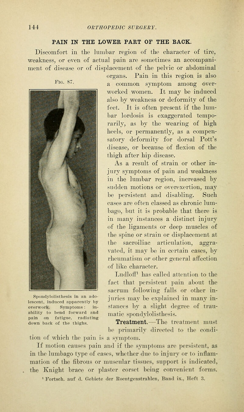 Fig. 8( PAIN IN THE LOWER PART OF THE BACK. Discomfort in the lumbar region of the character of tire, weakness, or even of actual pain are sometimes an accompani- ment of disease or of displacement of the pelvic or abdominal organs. Pain in this region is also a common symptom among over- worked women. It may be induced also by weakness or deformity of the feet. It is often present if the lum- bar lordosis is exaggerated tempo- rarily, as by the wearing of high heels, or permanently, as a compen- satory deformity for dorsal Pott's disease, or because of flexion of the thigh after hip disease. As a result of strain or other in- jury symptoms of pain and weakness in the lumbar region, increased by sudden motions or overexertion, may be persistent and disabling. Such cases are often classed as chronic lum- bago, but it is probable that there is in many instances a distinct injury of the ligaments or deep muscles of the spine or strain or displacement at the sacroiliac articulation, aggra- vated, it may be in certain cases, by rheumatism or other general affection of like character. Ludloff^ has called attention to the fact that persistent pain about the sacrum following falls or other in- juries may be explained in many in- stances by a slight degree of trau- matic spondylolisthesis. Treatment.—The treatment must be primarily directed to the condi- tion of which the pain is a sym]:»toni. If motion causes pain and if the symptoms are persistent, as in the lumbago type of cases, whether due to injury or to inflam- mation of the fibrous or muscular tissues, support is indicated, the Knight brace or plaster corset being convenient forms. ' Fortsch. auf d. Gebiete der Eoentgenstrahlen, Band ix.. Heft 3. Spondylolisthesis in an ado- lescent, induced apparently by overwork. Symptoms : in- ability to bend forward and pain on fatigue, radiating down back of the thighs.