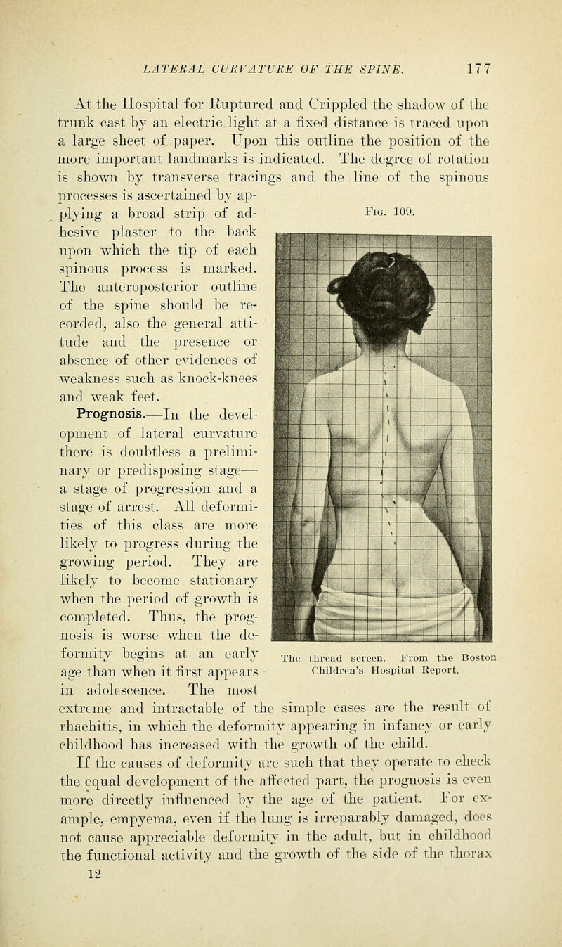 Fig. 109. At the Hospital for Ruptured and Crippled the shadow of the trunk cast by an electric light at a fixed distance is traced upon a large sheet of paper. Upon this outline the position of the more important landmarks is indicated. The degree of rotation is shown by transverse tracings and the line of the spinous processes is ascertained by ap- plying a broad strip of ad- hesive plaster to the back upon which the tip of each spinous process is marked. The anteroposterior outline of the spine should be re- corded, also the general atti- tude and the presence or absence of other evidences of weakness such as knock-knees and weak feet. Prognosis.—lu the devel- opment of lateral curvature there is doubtless a prelimi- nary or predisposing stage— a stage of progression and a stage of arrest. All deformi- ties of this class are more likely to progress during the growing period. They are likely to become stationary when the period of growth is completed. Thus, the prog- nosis is worse when the de- formity begins at an early age than when it first appears in adolescence. The most extreme and intractable of the simple cases are the result of rhachitis, in which the deformity appearing in infancy or early childhood has increased with the growth of the child. If the causes of deformity are such that they operate to check the equal development of the affected part, the prognosis is even more directly influenced by the age of the patient. For ex- ample, empyema, even if the lung is irreparably damaged, does not cause appreciable deformity in the adult, but in childhood the functional activity and the growth of the side of the thorax 12 ' 1 1 J V , 1 .J 1 k 1 1 1 ! J t mk i iV, 1 1 / flj Hp It \ 9 ^H ' wSBk HEi Ih, ■B -~ > —' r- III ■HI ^^ HI W* 4?i 1 \ ^m ^ w H .ma > ^k g 1 F /I 1 h - ^4^ 1 ^^^^^^ l_ „  m ■ M — I dUH —_ [ L ! 1 1 —_j \—~— 1— f UBg The thread screen. Prom the Boston Children's Hospital Report.