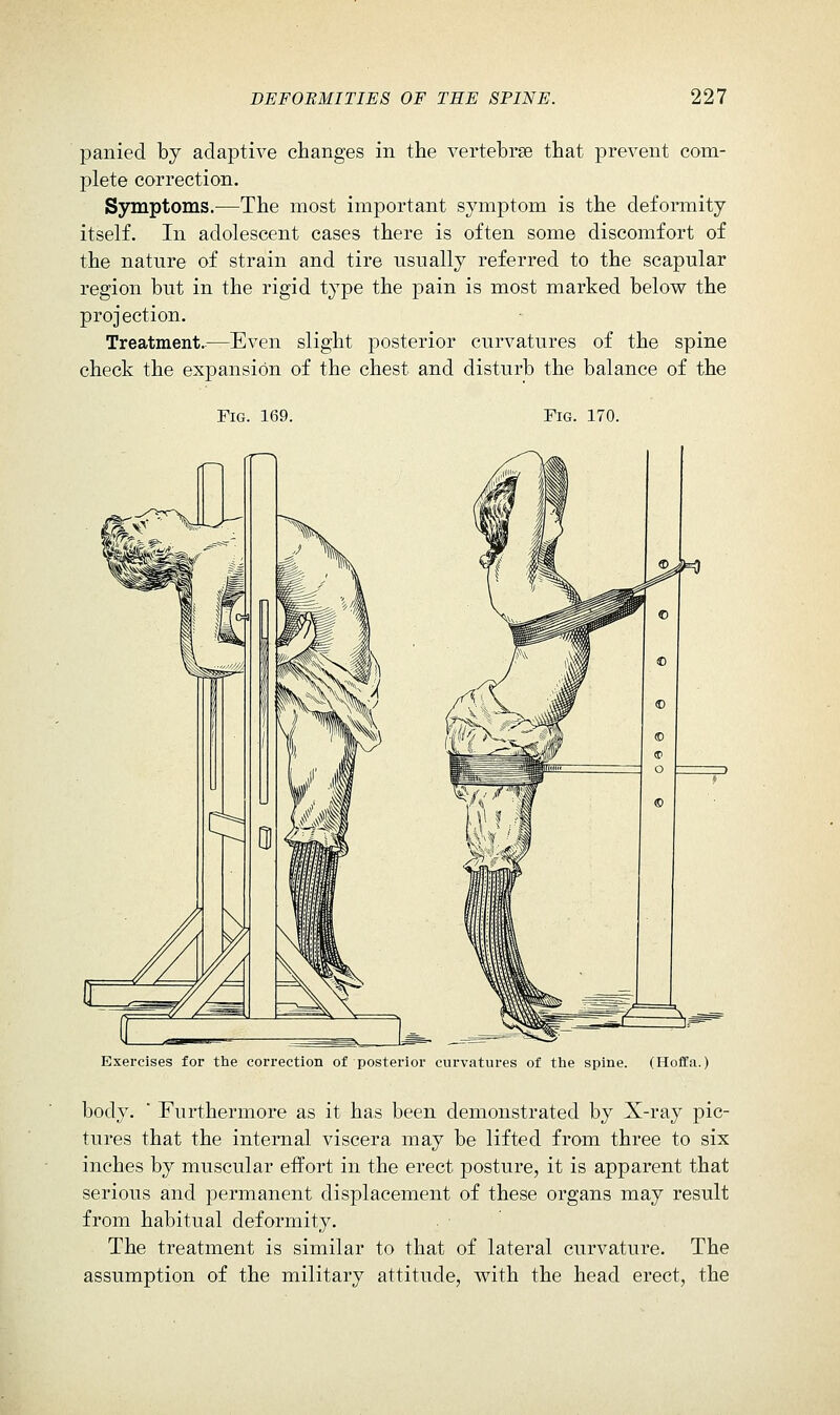 panied by adaptive changes in the vertebrae that prevent com- plete correction. Ssmiptoms.—The most important symptom is the deformity itself. In adolescent cases there is often some discomfort of the nature of strain and tire usually referred to the scapular region but in the rigid type the pain is most marked below the projection. Treatment.—Even slight posterior curvatures of the spine check the expansion of the chest and disturb the balance of the Fig. 169. Fig. 170. Exercises for the correction of posterior curvatures of the spine. (Hoffa.) body. ■ Furthermore as it has been demonstrated by X-ray pic- tures that the internal viscera may be lifted from three to six inches by muscular effort in the erect posture, it is apparent that serious and permanent displacement of these organs may result from habitual deformity. The treatment is similar to that of lateral curvature. The assumption of the military attitude, with the head erect, the