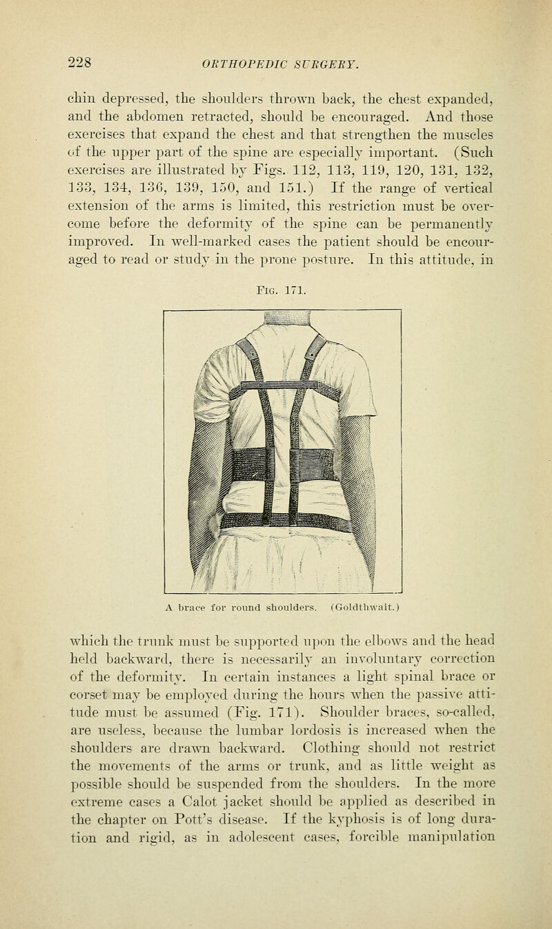 cliin depressed, the shoulders thrown back, the chest expanded, and the abdomen retracted, should be encouraged. And those exercises that expand the chest and that strengthen the muscles of the upper jiart of the spine are especiallv important. (Such exercises are illustrated by Figs. 112, 113, 119, 120, 131, 132, 133, 134, 136, 139, 150, and 151.) If the range of vertical extension of the arms is limited, this restriction must be over- come before the deformity of the spine can be permanently improved. In well-marked cases the patient should be encour- aged to read or study in the prone posture. In this attitude, in Fig. 171. A brace for round shoulders. (Goldthwait. which the trunk must be supported upon the elbows and the head held backward, there is necessarily an involuntary correction of the deformity. In certain instances a light spinal brace or corset may be employed during the hours when the passive atti- tude must be assumed (Fig. ITl). Shoulder braces, so-called, are useless, because the lumbar lordosis is increased when the shoulders are drawn backward. Clothing should not restrict the movements of the arms or trunk, and as little weight as possible should be suspended from the shoulders. In the more extreme cases a Calot jacket should be applied as described in the chapter on Pott's disease. If the kyphosis is of long dura- tion and rigid, as in adolescent cases, forcible manipulation