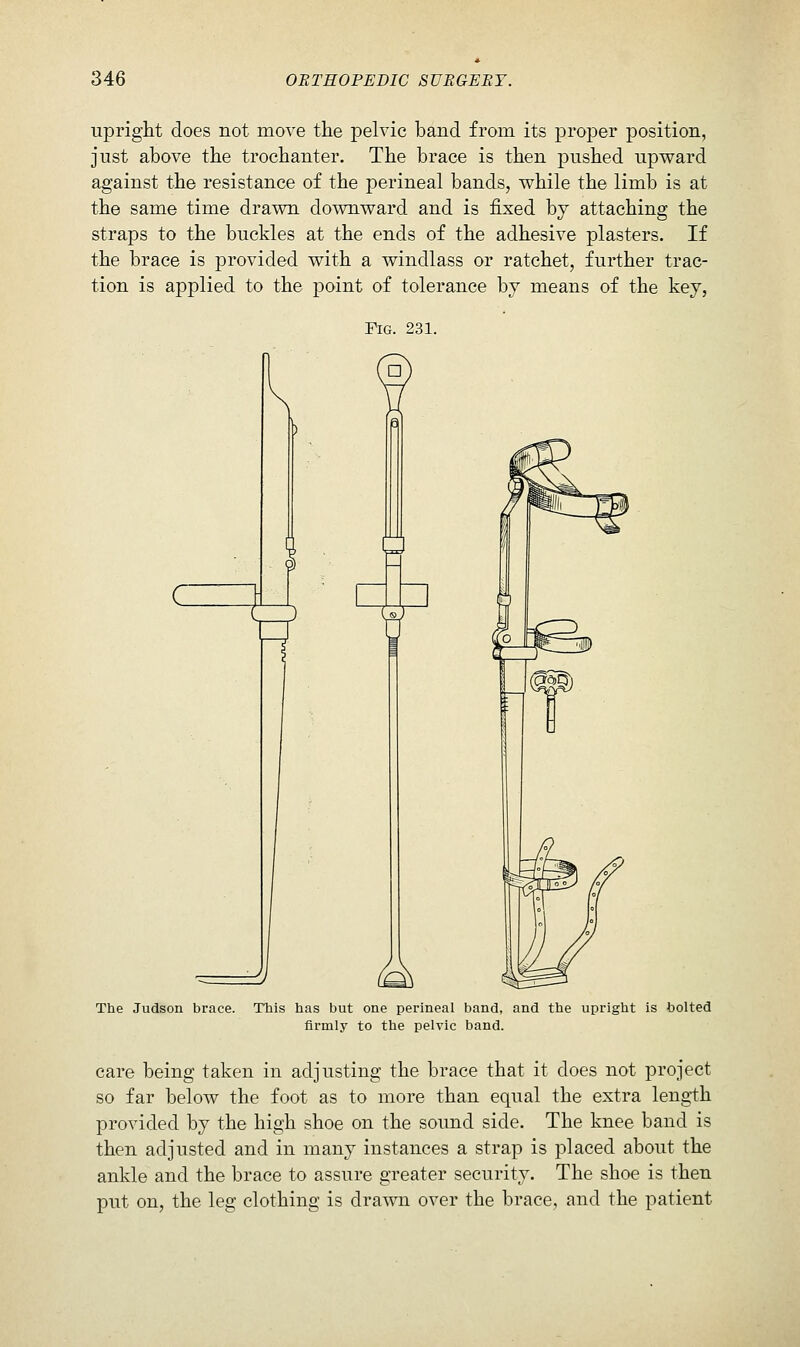 upright does not move the pelvic band from its proper position, just above the trochanter. The brace is then pushed upward against the resistance of the perineal bands, while the limb is at the same time drawn downward and is fixed hj attaching the straps to the buckles at the ends of the adhesive plasters. If the brace is provided with a windlass or ratchet, further trac- tion is applied to the point of tolerance bv means of the key, c The Judson brace. This has but one perineal band, and the upright is bolted firmly to the pelvic band. care being taken in adjusting the brace that it does not project so far below the foot as to more than equal the extra length provided by the high shoe on the sound side. The knee band is then adjusted and in many instances a strap is placed about the ankle and the brace to assure greater security. The shoe is then put on, the leg clothing is drawn over the brace, and the patient