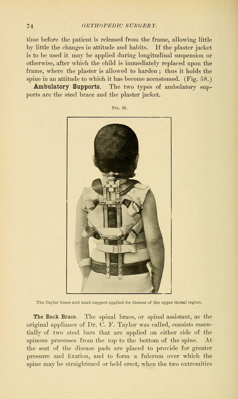 time before the patient is released from the frame, allowing little by little the changes in attitude and habits. If the plaster jacket is to be used it may be applied during longitudinal suspension or otherwise, after which the child is immediately replaced upon the frame, where the plaster is allowed to harden; thus it holds the spine in an attitude to which it has become accustomed. (Fig. 58.) Ambulatory Supports. The two types of ambulatory sup- ports are the steel brace and the plaster jacket. Fig. 35. The Taylor brace and head support applied for disease of the upper dorsal region. The Back Brace. The spinal brace, or spinal assistant, as the original appliance of Dr. C. F. Taylor was called, consists essen- tially of two steel bars that are applied on either side of the spinous processes from the top to the bottom of the spine. At the seat of the disease pads are placed to provide for greater pressure and fixation, and to form a fulcrum over which the spine may be straightened or held erect, when the two extremities