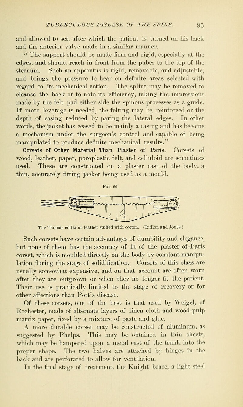 and allowed to set, after which the patient is turned on his back and the anterior valve made in a similar manner.  The support should be made firm and rigid, especially at the edges, and should reach in front from the pubes to the top of the sternum. Such an apparatus is rigid, removable, and adjustable, and brings the pressure to bear on definite areas selected with regard to its mechanical action. The splint may be removed to cleanse the back or to note its efficiency, taking the impressions made by the felt pad either side the spinous processes as a guide. If more leverage is needed, the felting may be reinforced or the depth of casing reduced by paring the lateral edges. In other words, the jacket has ceased to be mainly a casing and has become a mechanism under the surgeon's control and capable of being manipulated to produce definite mechanical results. Corsets of Other Material Than Plaster of Paris. Corsets of wood, leather, paper, poroplastic felt, and celluloid are sometimes used. These are constructed on a plaster cast of the body, a thin, accurately fitting jacket being used as a mould. Fig. 60. The Thomas collar of leather stuffed with cotton. (Ridlon and Jones.) Such corsets have certain advantages of durability and elegance, but none of them has the accuracy of fit of the plaster-of-Paris corset, which is moulded directly on the body by constant manipu- lation during the stage of solidification. Corsets of this class are usually somewhat expensive, and on that account are often worn after they are outgrown or when they no longer fit the patient. Their use is practically limited to the stage of recovery or for other affections than Pott's disease. Of these corsets, one of the best is that used by Weigel, of Rochester, made of alternate layers of linen cloth and wood-pulp matrix paper, fixed by a mixture of paste and glue. A more durable corset may be constructed of aluminum, as suggested by Phelps. This may be obtained in thin sheets, which may be hampered upon a metal cast of the trunk into the proper shape. The two halves are attached by hinges in the back and are perforated to allow for ventilation. In the final stage of treatment, the Knight brace, a light steel