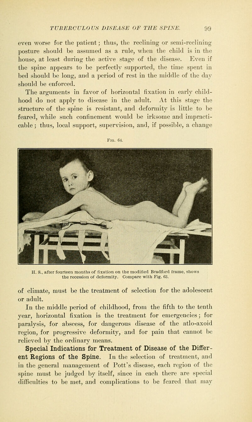 even worse for the patient; thus, the reclining or semi-reclining posture should be assumed as a rule, when the child is in the house, at least during the active stage of the disease. Even if the spine appears to be perfectly supported, the time spent in bed should be long, and a period of rest in the middle of the day should be enforced. The arguments in favor of horizontal fixation in early child- hood do not apply to disease in the adult. At this stage the structure of the spine is resistant, and deformity is little to be feared, while such confinement would be irksome and impracti- cable ; thus, local support, supervision, and, if possible, a change Fig. 64. H. S., after fourteen months of fixation on the modified Bradford frame, shows the recession of deformity. Compare with Fig. 63. of climate, must be the treatment of selection for the adolescent or adult. In the middle period of childhood, from the fifth to the tenth year, horizontal fixation is the treatment for emergencies; for paralysis, for abscess, for dangerous disease of the atlo-axoid region, for progressive deformity, and for pain that cannot be relieved by the ordinary means. Special Indications for Treatment of Disease of the Differ- ent Regions of the Spine. In the selection of treatment, and in the general management of Pott's disease, each region of the spine must be judged by itself, since in each there are special difficulties to be met, and complications to be feared that may