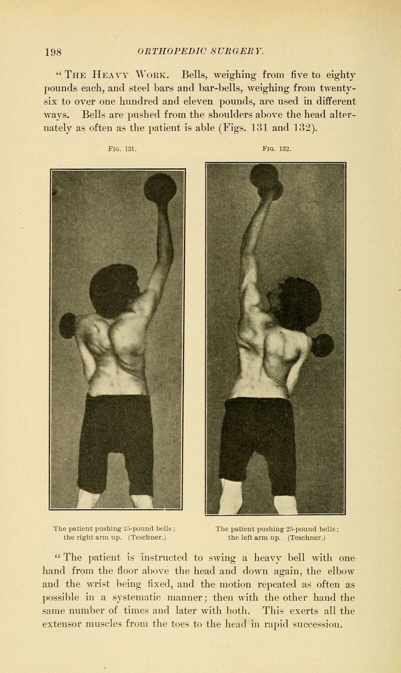  The Heavy Work. Bells, weighing from five to eighty pounds each, and steel bars and bar-bells, weighing from twenty- six to over one hundred and eleven pounds, are used in dijBPerent ways. Bells are pushed from the shoulders above the head alter- nately as often as the patient is able (Figs. 131 and 132). Fig. 131. Fig. 132. The patient pushing 25-pound bells ; the right arm up. (Teschner.) The patient pushing 2.5-pound bells; the left arm up. (Teschner.) The patient is instructed to swing a heavy bell with one hand from the floor above the head and down again, the elbow and the wrist being fixed, and the motion repeated as often as possible in a systematic manner; then with the other hand the same number of times and later with both. This exerts all the extensor muscles from the toes to the head in rapid succession.