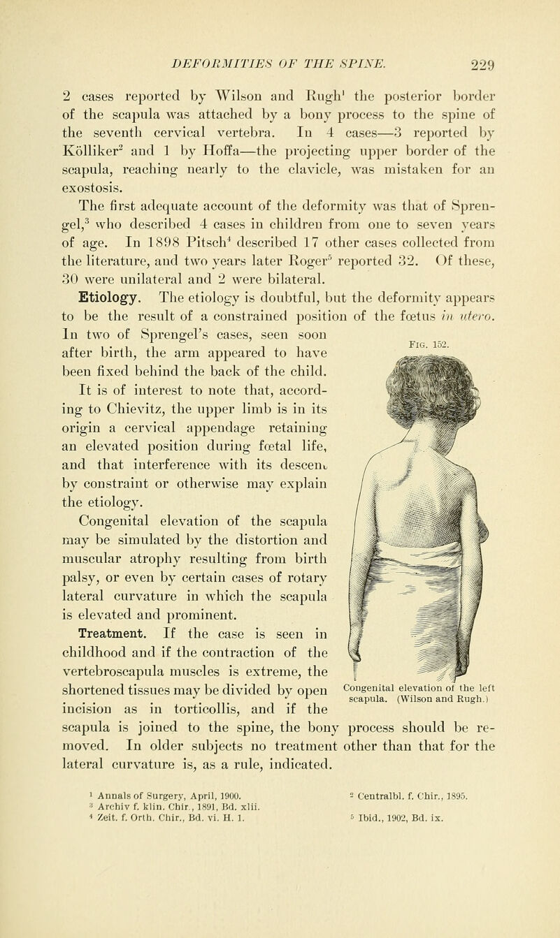 Fig 152 2 cases reported by Wilson and Rugh' the posterior border of the scapula was attached by a bony process to the spine of the seventh cervical vertebra. In 4 cases—3 reported by Kolliker^ and 1 by Hoffa—the projecting upper border of the scapula, reaching nearly to the clavicle, was mistaken for an exostosis. The first adequate account of the deformity was that of Spren- gel,^ who described 4 cases in children from one to seven years of age. In 1898 Pitsch* described 17 other cases collected from the literature, and two years later Roger^ reported 32. Of these, 30 were unilateral and 2 were bilateral. Etiology. The etiology is doubtful, but the deformity appears to be the result of a constrained position of the fcetus in utero. In two of Sprengel's cases, seen soon after birth, the arm appeared to have been fixed behind the back of the child. It is of interest to note that, accord- ing to Chievitz, the upper limb is in its origin a cervical appendage retaining an elevated position during foetal life, and that interference with its desceui. by constraint or otherwise may explain the etiology. Congenital elevation of the scapula may be simulated by the distortion and muscular atrophy resulting from birth palsy, or even by certain cases of rotary lateral curvature in which the scapula is elevated and prominent. Treatment. If the case is seen in childhood and if the contraction of the vertebroscapula muscles is extreme, the shortened tissues may be divided by open incision as in torticollis, and if the scapula is joined to the spine, the bony process should be re- moved. In older subjects no treatment other than that for the lateral curvature is, as a rule, indicated. Congenital elevation of the left scapula. (Wilson and Rugh.) I Annals of Surgery, April, 1900. '■■ Archiv f. klin. Chir., 189], Bd. xlii. ■• Zeit. f. Orlh. Chir., Bd. vi. H. 1. 2 Centralbl. f. Chir., 1895. Ibid., 1902, Bd. ix.