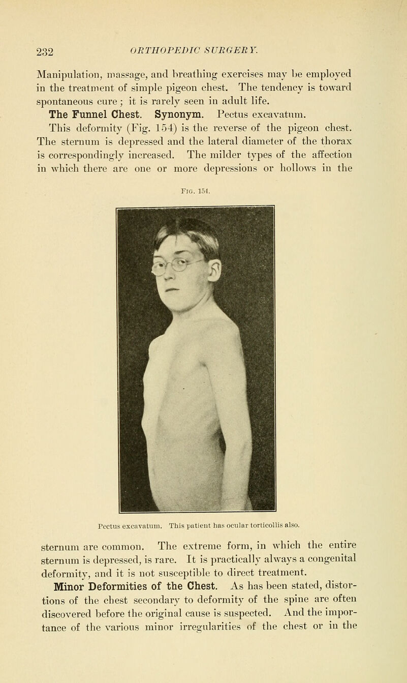 Manipulation, massage, and breathing exercises may be employed in the treatment of simple pigeon chest. The tendency is toward spontaneous cure; it is rarely seen in adult life. The Funnel Chest. Synonym. Pectus excavatum. This deformity (Fig. 154) is the reverse of the pigeon chest. The sternum is depressed and the lateral diameter of the thorax is correspondingly increased. The milder types of the affection in which there are one or more depressions or hollows in the Fig. 154. Pectus excavatum. This patient has ocular torticollis also. sternum are common. The extreme form, in which the entire sternum is depressed, is rare. It is practically always a congenital deformity, and it is not susceptible to direct treatment. Minor Deformities of the Chest. As has been stated, distor- tions of the chest secondary to deformity of the spine are often discovered before the original cause is suspected. And the impor- tance of the various minor irregularities of the chest or in the