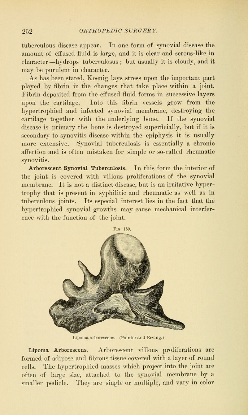 tuberculous disease appear. In one form of synovial disease the amount of effused fluid is large, and it is clear and serous-like in character —hydrops tuberculosus ; but usually it is cloudy, and it may be purulent in character. As has been stated, Koenig lays stress upon the important part played by fibrin in the changes that take place within a joint. Fibrin deposited from the effused fluid forms in successive layers upon the cartilage. Into this fibrin vessels grow from the hypertrophied and infected synovial membrane, destroying the cartilage together with the underlying bone. If the synovial disease is primary the bone is destroyed superficially, but if it is secondary to synovitis disease within the epiphysis it is usually more extensive. Synovial tuberculosis is essentially a chronic affection and is often mistaken for simple or so-called rheumatic synovitis. Arborescent Ssmovial Tuberculosis. In this form the interior of the joint is covered with villous proliferations of the synovial membrane. It is not a distinct disease, but is an irritative hyper- trophy that is present in syphilitic and rheumatic as well as in tuberculous joints. Its especial interest lies in the fact that the hypertrophied synovial growths may cause mechanical interfer- ence with the function of the joint. Fig. 159. Lipoma arborescens. (Painter and Erving.) Lipoma Arborescens. Arborescent villous proliferations are formed of adipose and fibrous tissue covered with a layer of round cells. The hypertrophied masses which project into the joint are often of large size, attached to the synovial membrane by a smaller pedicle. They are single or multiple, and vary in color