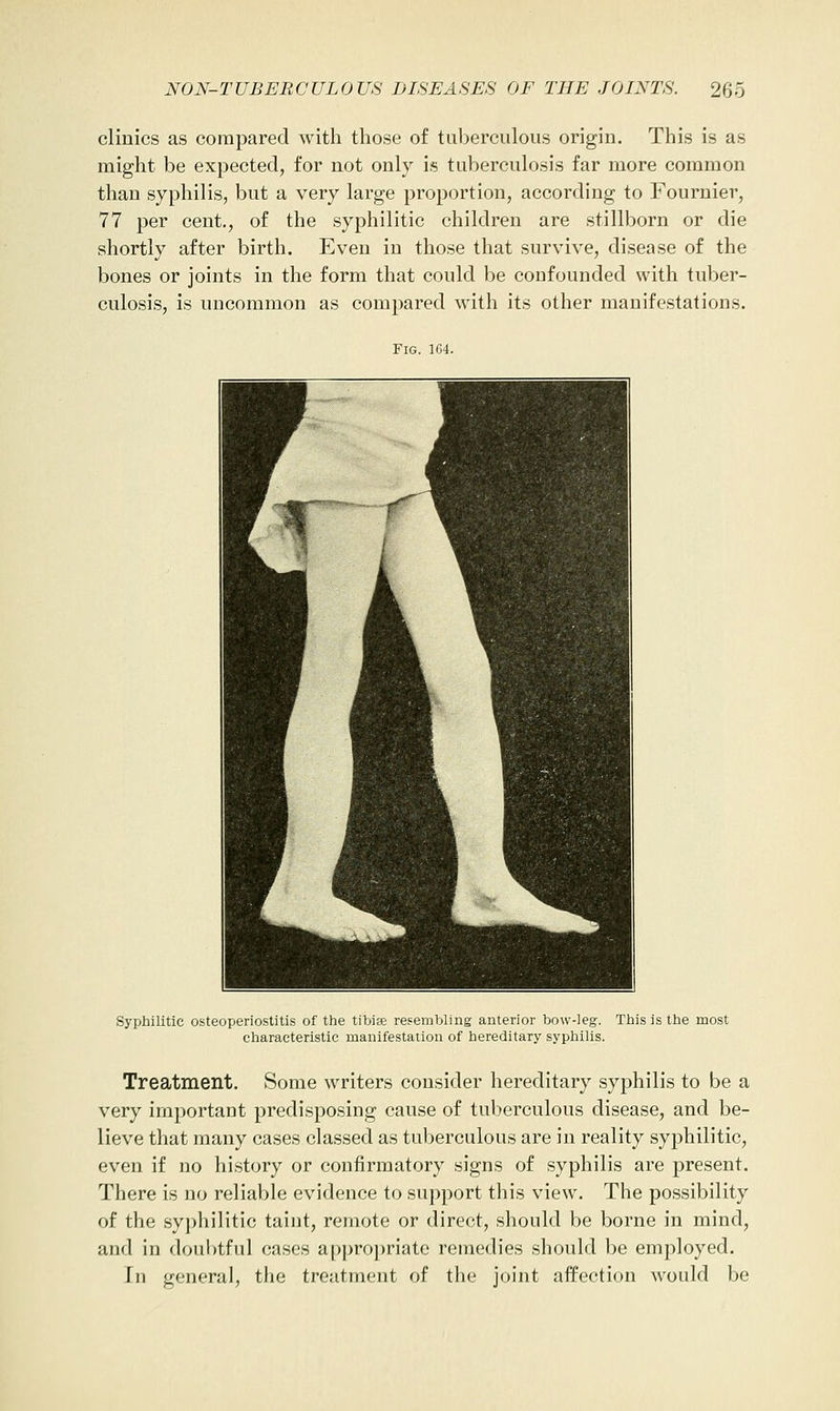 clinics as compared with those of tuberculous origin. This is as might be expected, for not only is tuberculosis far more common than syphilis, but a very large proportion, according to Fournier, 77 per cent., of the syphilitic children are stillborn or die shortly after birth. Even in those that survive, disease of the bones or joints in the form that could be confounded with tuber- culosis, is uncommon as compared with its other manifestations. Fig. 164. Syphilitic osteoperiostitis of the tibiae resembling anterior bow-leg. This is the most characteristic manifestation of hereditary syphilis. Treatment. Some writers consider hereditary syphilis to be a very important predisposing cause of tuberculous disease, and be- lieve that many cases classed as tuberculous are in reality syphilitic, even if no hi.story or confirmatory signs of syphilis are present. There is no reliable evidence to support this view. The possibility of the .syphilitic taint, remote or direct, should be borne in mind, and in doubtful cases appropriate remedies should be employed. In general, the treatment of the joint affection would be