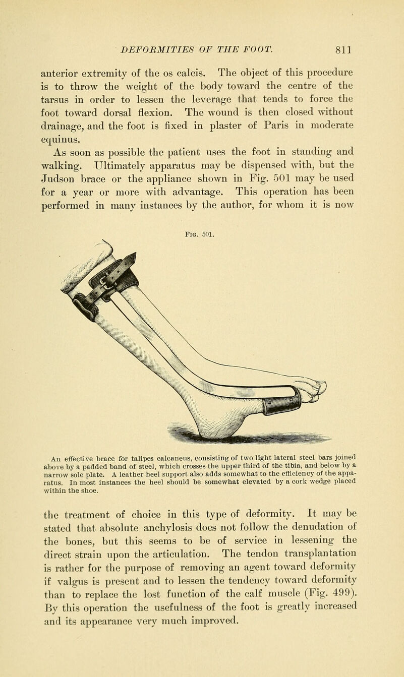 anterior extremity of the os calcis. The object of this procedure is to throw the weight of the body toward the centre of the tarsus in order to lessen the leverage that tends to force the foot toward dorsal flexion. The wound is then closed without drainage, and the foot is fixed in plaster of Paris in moderate equinus. As soon as possible the patient uses the foot in standing and walking. Ultimately apparatus may be dispensed with, but the Judson brace or the appliance shown in Fig. 501 may be used for a year or more with advantage. This operation has been performed in many instances by the author, for whom it is now Fig. 501. An effective brace for talipes calcaneus, consisting of two light lateral steel bars joined above by a padded band of steel, which crosses the upper third of the tibia, and below by a narrow sole plate. A leather heel support also adds somewhat to the efficiency of the appa- ratus. In most instances the heel should be somewhat elevated by a cork wedge placed within the shoe. the treatment of choice in this type of deformity. It may be stated that absolute anchylosis does not follow the denudation of the bones, but this seems to be of service in lessening the direct strain upon the articulation. The tendon transplantation is rather for the purpose of removing an agent toward deformity if valgus is present and to lessen the tendency toward deformity than to replace the lost function of the calf muscle (Fig. 499). By this operation the usefulness of the foot is greatly increased and its appearance very much improved.