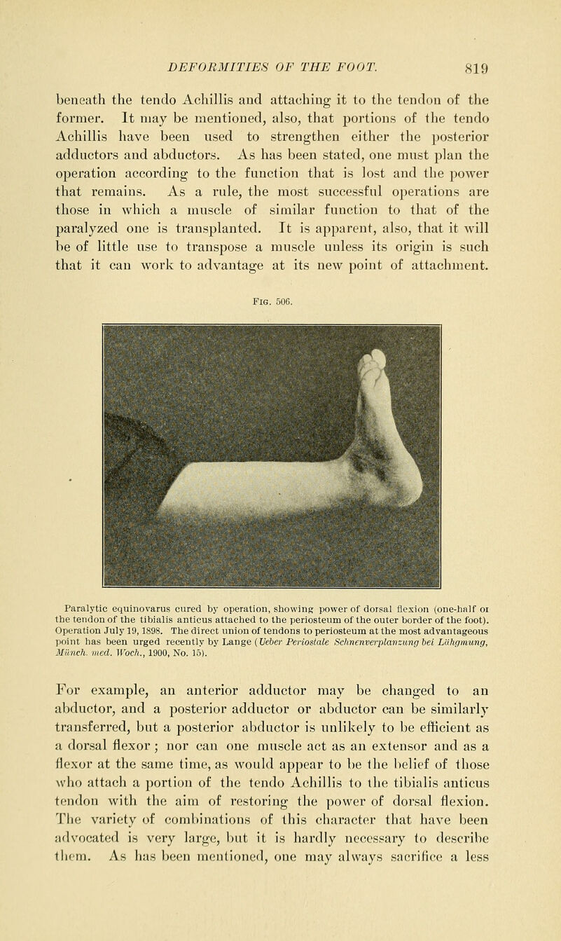 beneath the tenclo Achillis and attaching it to the tendon of the former. It may be mentioned, also, that portions of the tendo Achillis have been used to strengthen either the posterior adductors and abductors. As has been stated, one must plan the operation according to the function that is lost and the power that remains. As a rule, the most successful operations are those in which a muscle of similar function to that of the paralyzed one is transplanted. It is apparent, also, that it will be of little use to transpose a muscle unless its origin is such that it can work to advantage at its new point of attachment. Fig. 506. Paralytic equinovarus cured by operation, showing power of dorsal flexion (one-half oi the tendon of the tibialis anticus attached to the periosteum of the outer border of the foot). Operation July 19,1898. The direct union of tendons to periosteum at the most advantageous point has been urged recently by Lange ([/e6er Pej-iostafe Sdmenverplavzung bei Llihgmwig, Milnch. vied. Woch., 1900, No. 15). For example, an anterior adductor may be changed to an abductor, and a posterior adductor or abductor can be similarly transferred, but a posterior abductor is unlikely to be efficient as a dorsal flexor; nor can one muscle act as an extensor and as a flexor at the same time, as would appear to be the belief of those who attach a portion of the tendo Achillis to the tibialis anticus tendon with the aim of restoring the power of dorsal flexion. The variety of combinations of this character that have been advocated is very largo, but it is hardly necessary to describe them. As has been mentioned, one may always sacrifice a less