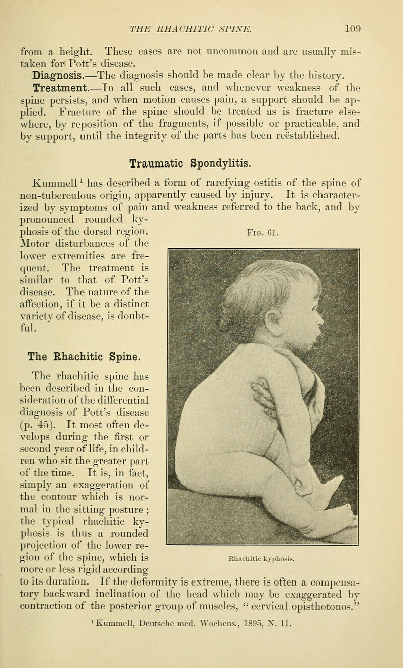 from a height. These cases are not uncommon and are usually mis- taken for Pott's disease. Diagnosis.—The diagnosis should be made clear by the history. Treatment.—In all such cases, and whenever weakness of the spine persists, and when motion causes pain, a support should be ap- plied. Fracture of the spine should be treated as is fracture else- where, by reposition of the fragments, if possible or practicable, and by support, until the integrity of the parts has been reestablished. Traumatic Spondylitis. Kummell ^ has described a form of rarefying ostitis of the spine of non-tuberculous origin, apparently caused by injury. It is character- ized by symptoms of pain and weakness referred to the back, and by pronounced rounded ky- phosis of the dorsal region. Fig. 61. Motor disturbances of the lower extremities are fre- quent. The treatment is similar to that of Pott's disease. The nature of the affection, if it be a distinct variety of disease, is doubt- ful. The Rhachitic Spine. The rhachitic spine has been described in the con- sideration of the diiferential diagnosis of Pott's disease (p. 45). It most often de- velops during the first or second year of life, in child- ren who sit the greater part of the time. It is, in fact, simply an exaggeration of the contour which is nor- mal in the sitting posture ; the typical rhachitic ky- phosis is thus a rounded projection of the lower re- gion of the spine, which is more or less rigid according to its duration. If the deformity is extreme, there is often a compensa- tory backward inclination of the head which may be exaggerated by contraction of the posterior group of muscles,  cervical opisthotonos. ' Kummel], Deutsche med. Wochens., 1895, X. 11. Ehachitic kyphosis.