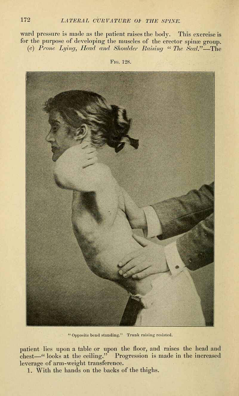 ward pressure is made as the patient raises the body. This exercise is for the purpose of developing the muscles of the erector spinse group. (c) Prone Lying, Head and Shoulder Raising  The SeaU'—The Fig. 128.  Opposite bend standing. Trunk raising resisted. patient lies upon a table or upon the floor, and raises the head and chest— looks at the ceiling. Progression is made in the increased leverage of arm-weight transference. 1. With the hands on the backs of the thighs.