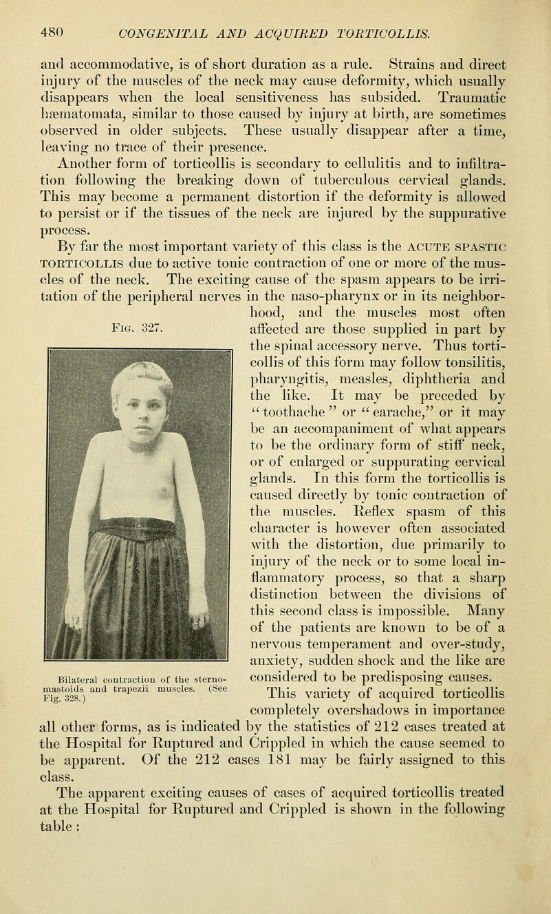 Fig. and accommodative, is of short duration as a rule. Strains and direct injury of the muscles of the neck may cause deformity, which usually disappears when the local sensitiveness has subsided. Traumatic hsematomata, similar to those caused by injury at birth, are sometimes observed in older subjects. These usually disappear after a time, leaving no trace of their presence. Another form of torticollis is secondary to cellulitis and to infiltra- tion following the breaking down of tuberculous cervical glands. This may become a permanent distortion if the deformity is allowed to persist or if the tissues of the neck are injured by the suppurative process. By far the most important variety of this class is the acute spastic TORTICOLLIS due to active tonic contraction of one or more of the mus- cles of the neck. The exciting cause of the spasm appears to be irri- tation of the peripheral nerves in the naso-pharynx or in its neighbor- hood, and the muscles most often affected are those supplied in part by the spinal accessory nerve. Thus torti- collis of this form may follow tonsilitis, pharyngitis, measles, diphtheria and the like. It may be preceded by  toothache  or  earache, or it may be an accompaniment of what appears to be the ordinary form of stiff neck, or of enlarged or suppurating cervical glands. In this form the torticollis is caused directly by tonic contraction of the muscles. Reflex spasm of this character is however often associated with the distortion, due primarily to injury of the neck or to some local in- flammatory process, so that a sharp distinction between the divisions of this second class is impossible. Many of the patients are known to be of a nervous temperament and over-study, anxiety, sudden shock and the like are considered to be predisposing causes. This variety of acquired torticollis completely overshadows in importance all other forms, as is indicated by the statistics of 212 cases treated at the Hospital for Ruptured and Crippled in which the cause seemed to be apparent. Of the 212 cases 181 may be fairly assigned to this class. The apparent exciting causes of cases of acquired torticollis treated at the Hospital for Ruptured and Crippled is shown in the following table : Bilateral contraction of tlie sterno- inastoids and trapezii muscles. (See Fig. 328.)