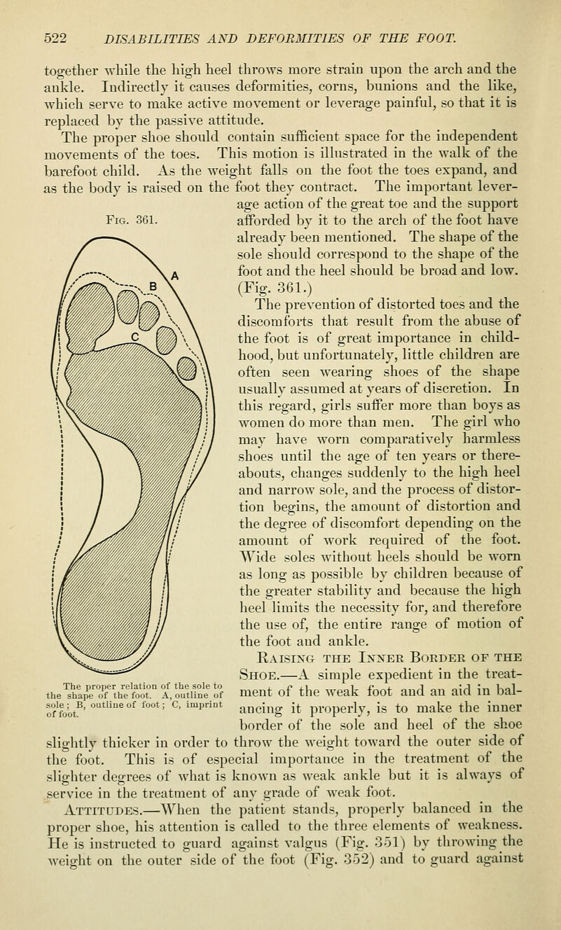 Fig. 361. together while the high heel throws more strain upon the arch and the ankle. Indix'ectly it causes deformities, corns, bunions and the like, which serve to make active movement or leverage painful, so that it is replaced by the passive attitude. The proper shoe should contain sufficient space for the independent movements of the toes. This motion is illustrated in the walk of the barefoot child. As the weight falls on the foot the toes expand, and as the body is raised on the foot they contract. The important lever- age action of the great toe and the support afforded by it to the arch of the foot have already been mentioned. The shape of the sole should correspond to the shape of the foot and the heel should be broad and low. (Fig. 361.) The prevention of distorted toes and the discomforts that result from the abuse of the foot is of great importance in child- hood, but unfortunately, little children are often seen wearing shoes of the shape usually assumed at years of discretion. In this regard, girls suffer more than boys as women do more than men. The girl who may have worn comparatively harmless shoes until the age of ten years or there- abouts, changes suddenly to the high heel and narrow sole, and the process of distor- tion begins, the amount of distortion and the degree of discomfort depending on the amount of work required of the foot. Wide soles without heels should be worn as long as possible by children because of the greater stability and because the high heel limits the necessity for, and therefore the use of, the entire range of motion of the foot and ankle. Raising the Ixxee Boedee of the Shoe.—A simple expedient in the treat- ment of the weak foot and an aid in bal- ancing it properly, is to make the inner border of the sole and heel of the shoe slightly thicker in order to throw the weight toward the outer side of the foot. This is of especial importance iu the treatment of the slighter degrees of what is known as weak ankle but it is always of service in the treatment of any grade of weak foot. Attitudes.—When the patient stands, properly balanced in the proper shoe, his attention is called to the three elements of weakness. He is instructed to guard against valgus (Fig. 351) by throwing the weight on the outer side of the foot (Fig. 352) and to guard against The proper relation of the sole to the shape of the foot. A, outline of sole ; B, outline of foot; C, imprint of foot.