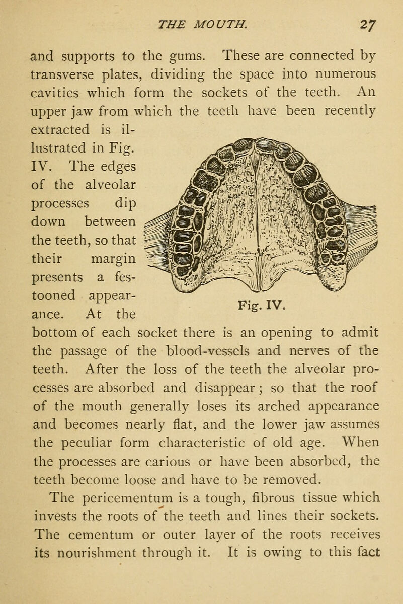 and supports to the gums. These are connected by transverse plates, dividing the space into numerous cavities which form the sockets of the teeth. An upper jaw from which the teeth have been recently extracted is il- lustrated in Fig. IV. The edges of the alveolar processes dip down between the teeth, so that their margin presents a fes- tooned appear- ance. At the bottom of each socket there is an opening to admit the passage of the blood-vessels and nerves of the teeth. After the loss of the teeth the alveolar pro- cesses are absorbed and disappear; so that the roof of the mouth generally loses its arched appearance and becomes nearly flat, and the lower jaw assumes the peculiar form characteristic of old age. When the processes are carious or have been absorbed, the teeth become loose and have to be removed. The pericementum is a tough, fibrous tissue which invests the roots of the teeth and lines their sockets. The cementum or outer layer of the roots receives its nourishment through it. It is owing to this fact Fig. IV.