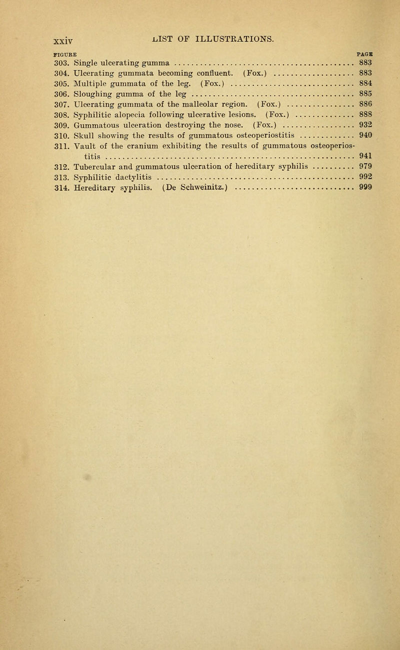 FIGURE PAGE 303. Single ulcerating gumma 883 304. Ulcerating gummata becoming confluent. (Fox.) 883 305. Multiple gummata of the leg. (Fox.) 884 306. Sloughing gumma of the leg 885 307. Ulcerating gummata of the malleolar region. (Fox.) 886 308. Syphilitic alopecia following ulcerative lesions. (Fox.) 888 309. Gummatous ulceration destroying the nose. (Fox.) , 932 310. Skull showing the results of gummatous osteoperiostitis 940 311. Vault of the cranium exhibiting the results of gummatous osteoperios- titis 941 312. Tubercular and gummatous ulceration of hereditary syphilis 979 313. Syphilitic dactylitis 992 314. Hereditary syphilis. (De Schweinitz.) 999