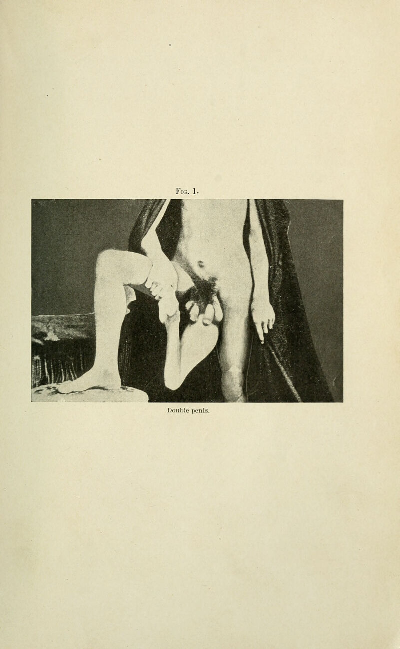 Fig. 1. Double penis.