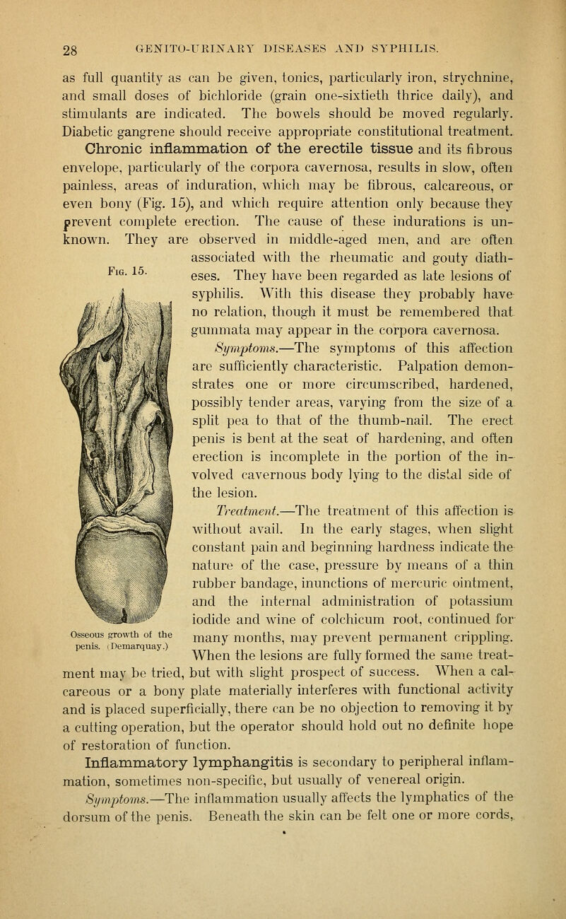 Fig. 15. as full quantity as can be given, tonics, particularly iron, strychnine, and small doses of bichloride (grain one-sixtieth thrice daily), and stimulants are indicated. The bowels should be moved regularly. Diabetic gangrene should receive appropriate constitutional treatment. Chronic inflammation of the erectile tissue and its fibrous envelope, particularly of the corpora cavernosa, results in slow, often painless, areas of induration, which may be fibrous, calcareous, or even bony (Fig. 15), and which require attention only because they prevent complete erection. The cause of these indurations is un- known. They are observed in middle-aged men, and are often associated with the rheumatic and gouty diath- eses. They have been regarded as late lesions of syphilis. With this disease they probably have no relation, though it must be remembered that gummata may appear in the corpora cavernosa. Symptoms.—The symptoms of this affection are sufficiently characteristic. Palpation demon- strates one or more circumscribed, hardened, possibly tender areas, varying from the size of a split pea to that of the thumb-nail. The erect penis is bent at the seat of hardening, and often erection is incomplete in the portion of the in- volved cavernous body lying to the distal side of the lesion. Treatment.—The treatment of this affection is v^^ithout avail. In the early stages, when slight constant pain and beginning hardness indicate the nature of the case, pressure by means of a thin rubber bandage, inunctions of mercuric ointment, and the internal administration of potassium iodide and wine of colchicum root, continued for many months, may prevent permanent crippling. When the lesions are fully formed the same treat- ment may be tried, but with slight prospect of success. When a cal- careous or a bony plate materially interferes with functional activity and is placed superficially, there can be no objection to removing it by a cutting operation, but the operator should hold out no definite hope of restoration of function. Inflammatory lymphangitis is secondary to peripheral inflam- mation, sometimes non-specific, but usually of venereal origin. Symptoms.—The inflammation usually affects the lymphatics of the dorsum of the penis. Beneath the skin can be felt one or more cords,. Osseous growth of the penis. (Demarquay.)