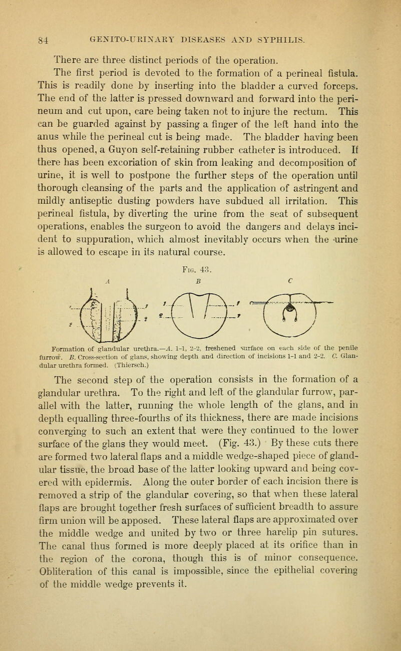There are three distinct periods of the operation. The first period is devoted to the formation of a perineal fistula. This is readily done by inserting into the bladder a curved forceps. The end of the latter is pressed downward and forward into the peri- neum and cut upon, care being taken not to injure the rectum. This can be guarded against by passing a finger of the left hand into the anus while the perineal cut is being made. The bladder ha\ing been thus opened, a Guyon self-retaining rubber catheter is introduced. If there has been excoriation of skin from leaking and decomposition of urine, it is well to postpone the further steps of the operation until thorough cleansing of the parts and the application of astringent and mildly antiseptic dusting powders have subdued all irritation. This perineal fistula, by diverting the urine from the seat of subsequent operations, enables the surgeon to avoid the dangers and delays inci- dent to suppuration, which almost inevitably occurs when the urine is allowed to escape in its natural course. Fig. 43. Formation of glandular urethra.—A. 1-1, 2-2, freshened siirface on each side of the penile furrow. B. Cross-section of glans, sho^^■ing depth and direction of incisions 1-1 and 2-2. C. Glan- dular urethra formed. (Thiersch.) The second step of the operation consists in the formation of a glandular urethra. To the right and left of the glandular furrow, par- allel with the latter, running the whole length of the glans, and in depth equalling three-fourths of its thickness, there are made incisions converging to such an extent that were they continued to the lower surface of the glans they would meet. (Fig. 43.) By these cuts there are formed two lateral flaps and a middle wedge-shaped piece of gland- ular tissue, the broad base of the latter looking upward and being cov- ered with epidermis. Along the outer border of each incision there is removed a strip of the glandular covering, so that when these lateral flaps are brought together fresh surfaces of sufficient breadth to assure firm union will be apposed. These lateral flaps are approximated over the middle wedge and united by two or three harelip pin sutures. The canal thus formed is more deeply placed at its orifice than in the region of the corona, though this is of minor consequence. Obliteration of this canal is impossible, since the epithelial covering of the middle wedge prevents it.