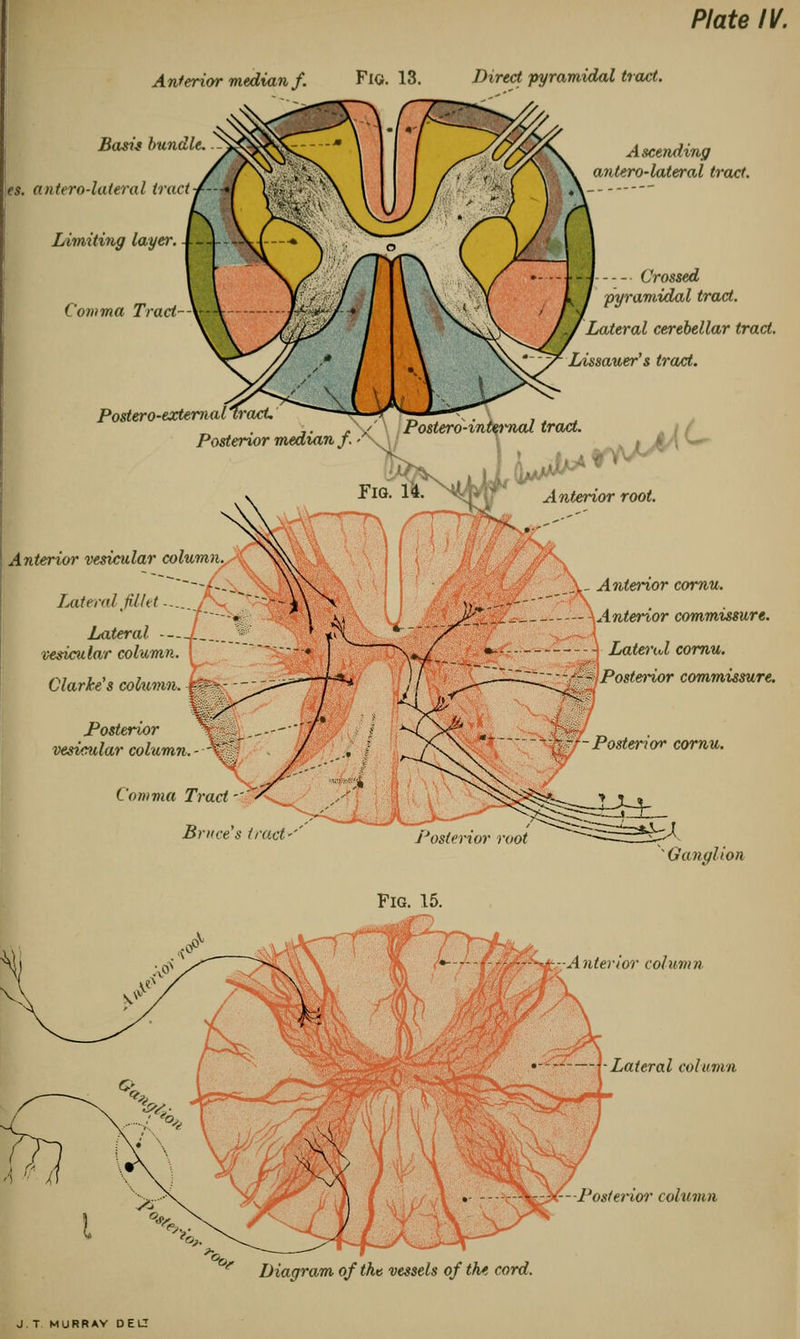 Plate IV. Anterior median/. Fig. 13. Direct pyramidal tract. Basis bundle, es. antero-lateral tract Limiting layer. -BB Comma Tract Ascending antero-lateral tract. Crossed pyramidal tract. Lateral cerebellar tract. Lissauer's tract. Postero-external.. ,. .' / Postero-internal tract. Posterior median j. '\\/ >K^( ' : Anterior root. Anterior vesicular column Lateral fillet... Lateral 1 vesicular column. Clarke's column. Posterior vesicular column \_ Anterior cornu. Anterior commissure. Latend cornu. '^Posterior commissure. U0- Posterior cornu. Ganglion .interior column — -Lateral column -Posterior column Diagram of tht vessels of the cord. J. T MURRAY DELT