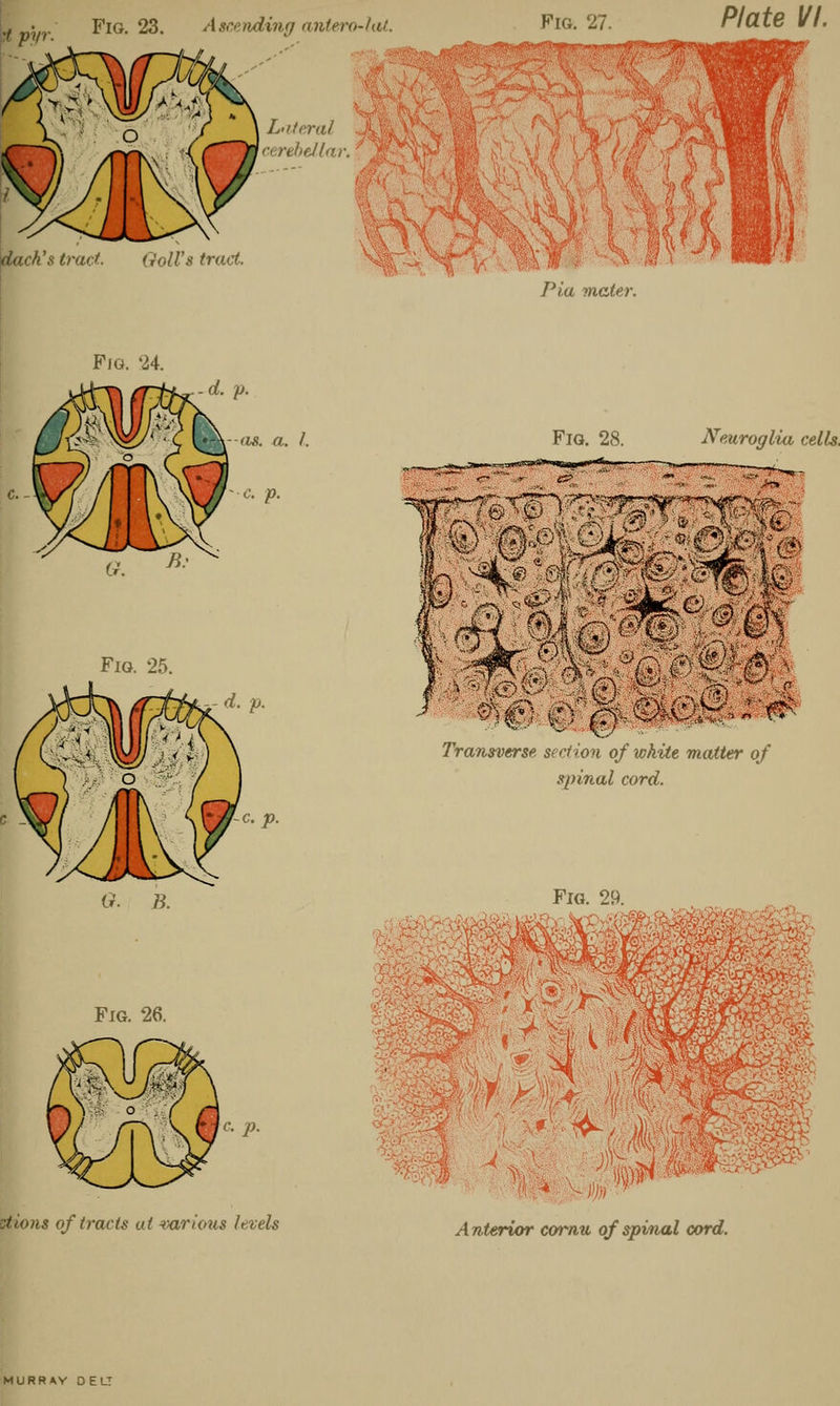 rt p'yr. Fig. 23. Ascending antero-lat. Lateral •erebellar. dach's tract.. God's tract. Fig. 27. Plate VI. Pla mater. S \v ' j>. Fig. 24. Fig. 25. -c. p. G. B. Fig. 26. c. p. ztions of tracts at various levels Fig. 28. Neuroglia cells. *-y <® ■/•to : mm' Transverse section of white matter of spinal cord. Fig. 29. -; 2$2 •'.•:-'\vr:::.*r-iij*ffl^^> /t7i<«rtor coma of spinal cord. MURRAY D E LT